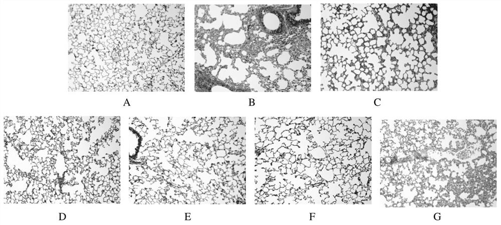 Application of a kind of phycocyanin peptide in the preparation of anti-pulmonary fibrosis medicine