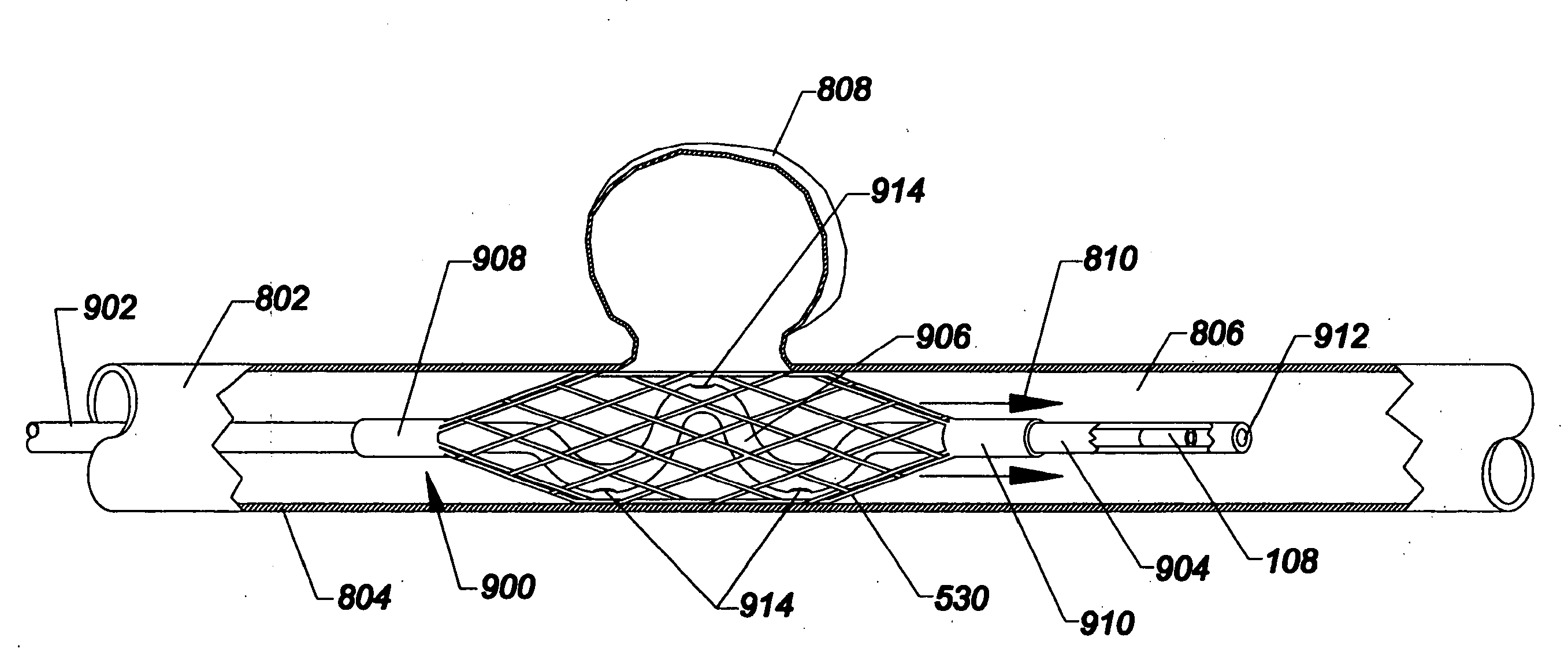 Multi-utilitarian microcatheter system and method of use