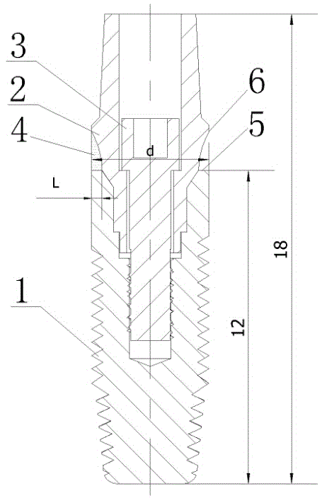 Artificial tooth root component