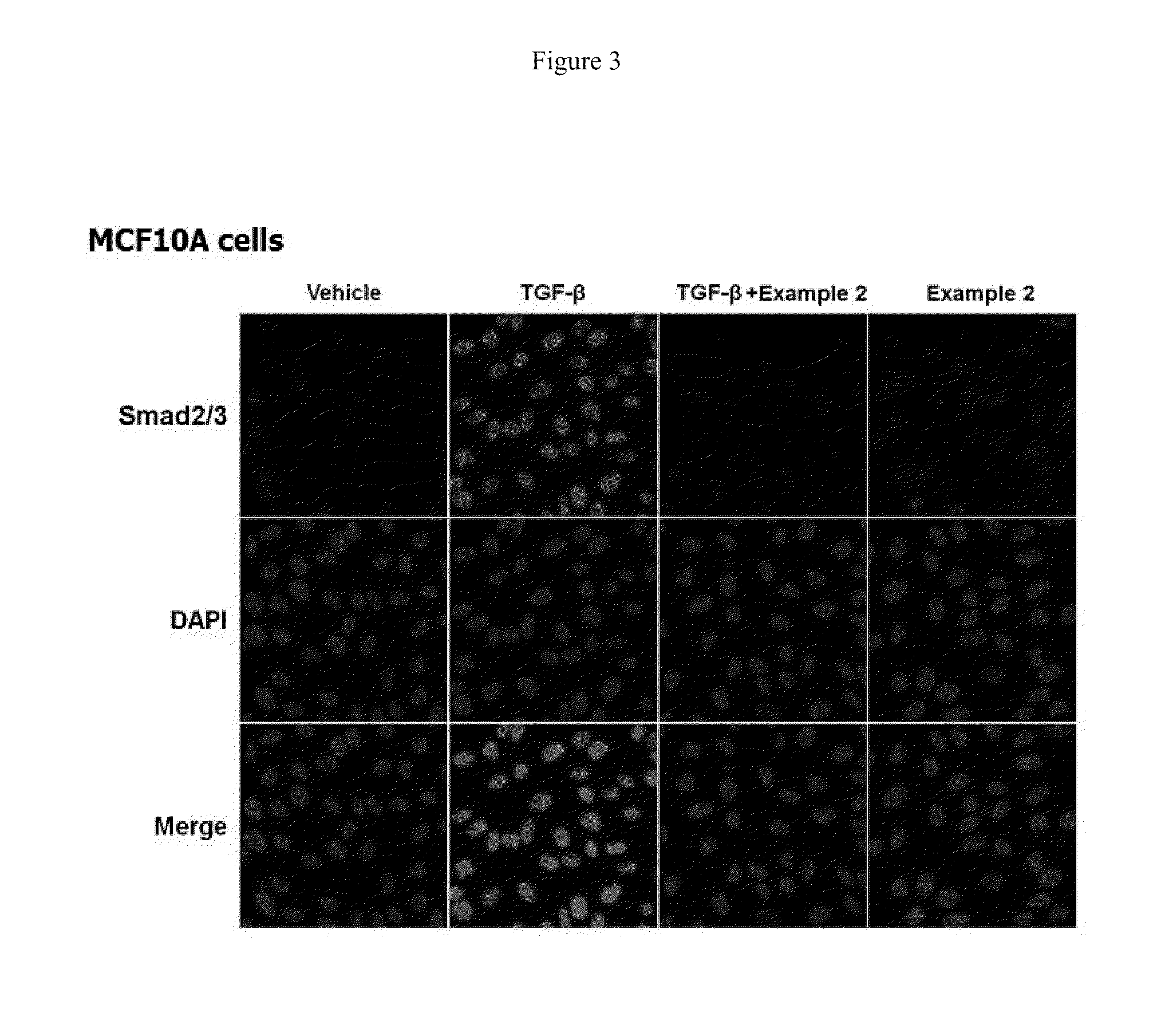 Methods of treating fibrosis, cancer and vascular injuries