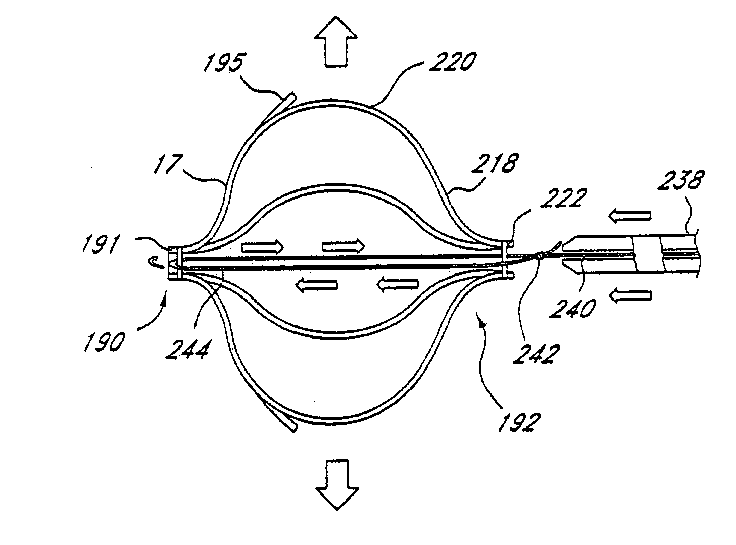 Adjustable left atrial appendage implant deployment system