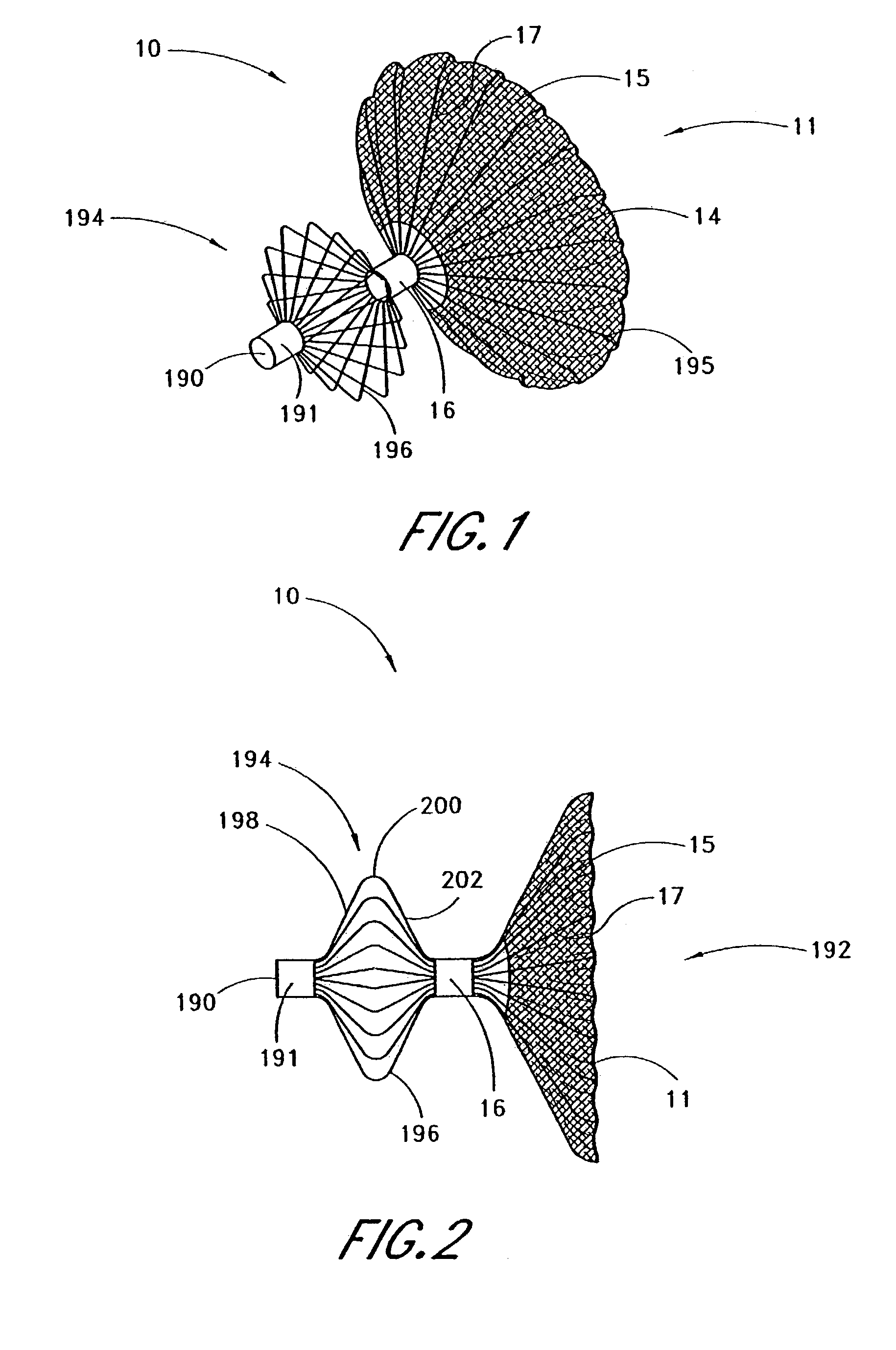 Adjustable left atrial appendage implant deployment system