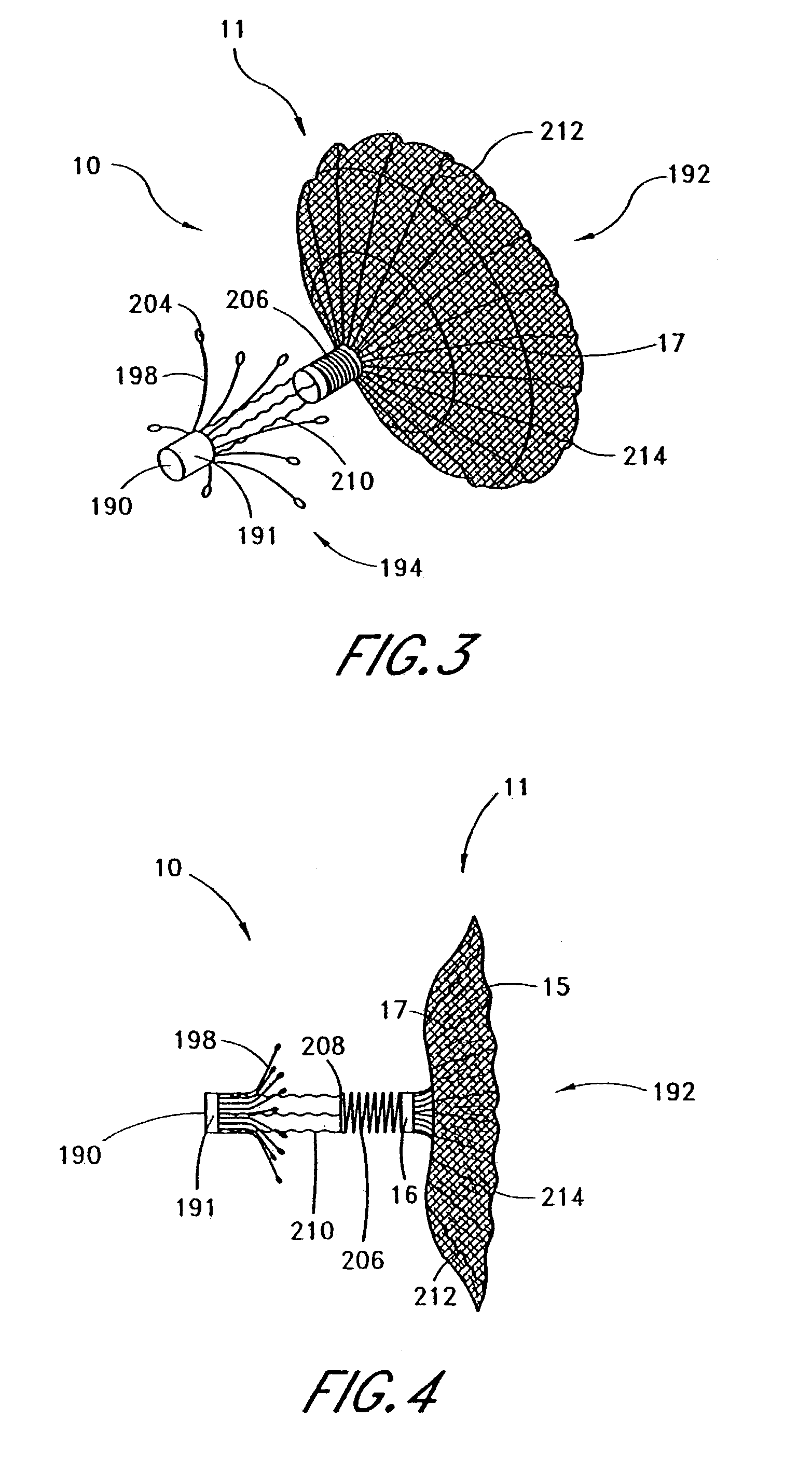 Adjustable left atrial appendage implant deployment system