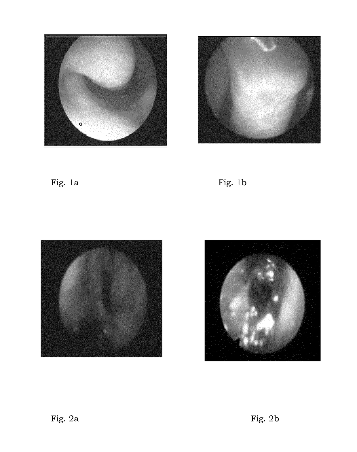 Pharmaceutical composition for use in increasing the trophism of nasal mucosa