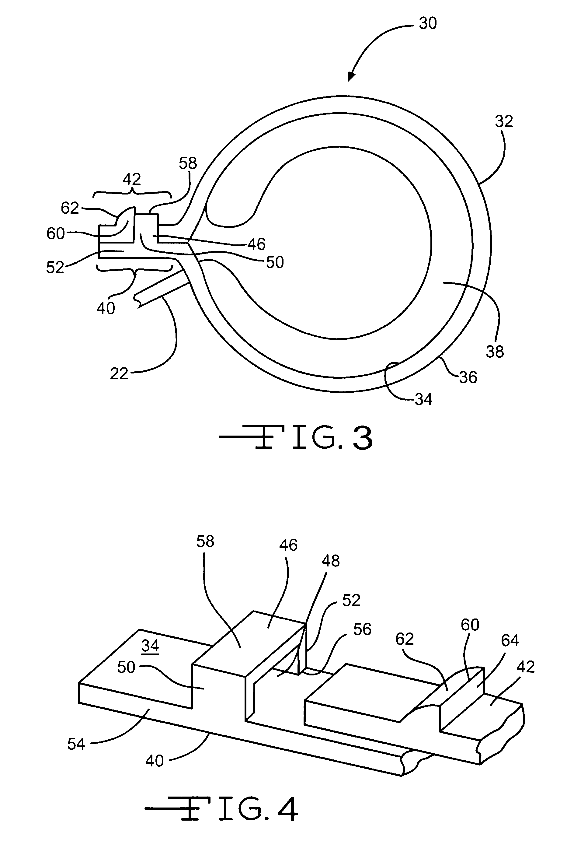 Implantable band with attachment mechanism