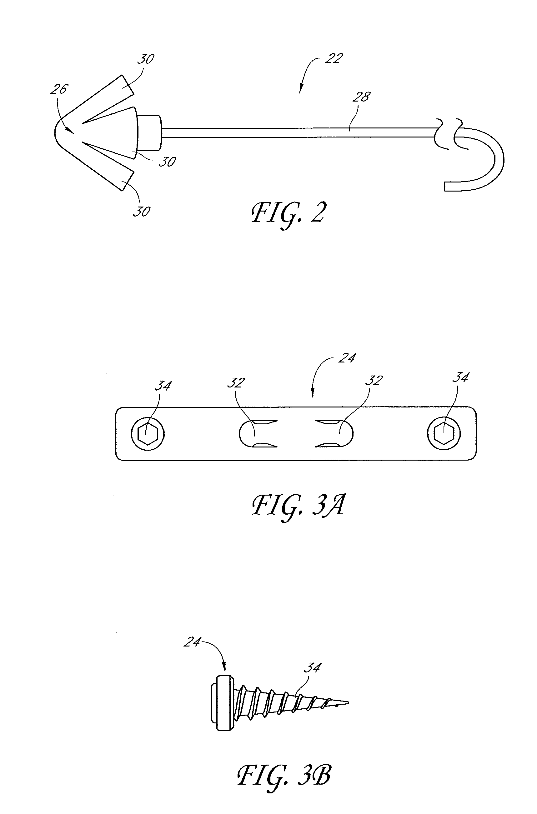 System and method for percutaneous palate remodeling