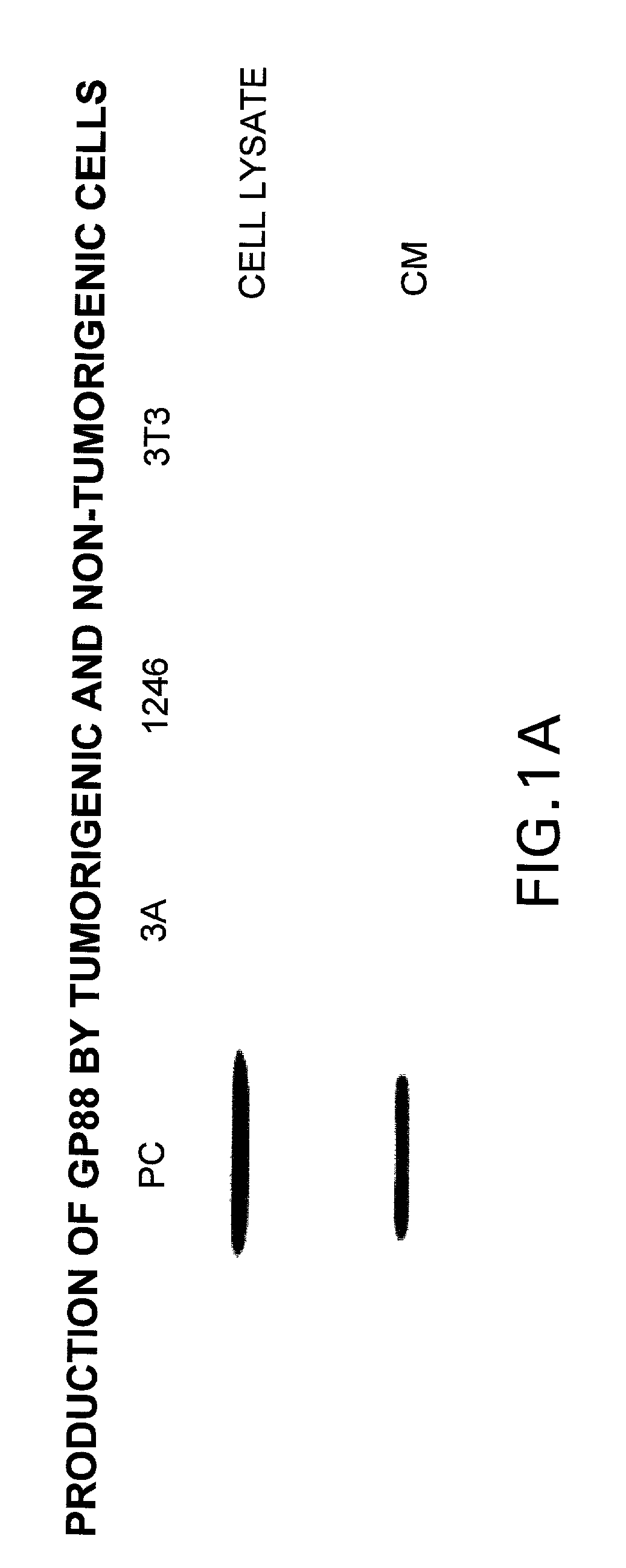 Methods and kits for diagnosing tumorigenicity and determining resistance to the antineoplastic effects of antiestrogen therapy