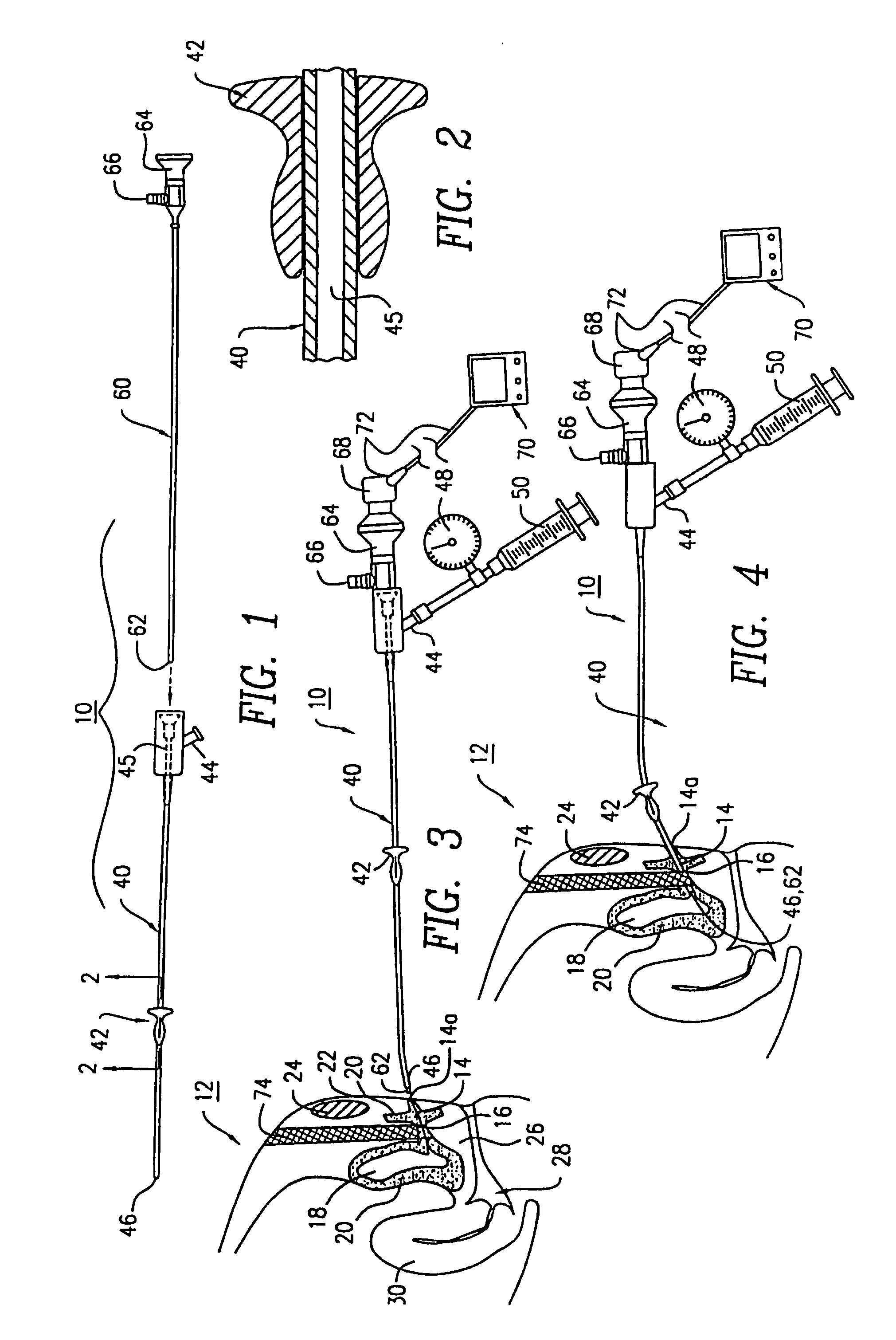 Apparatus and method for the measurement of the resistance of the urethral sphincter