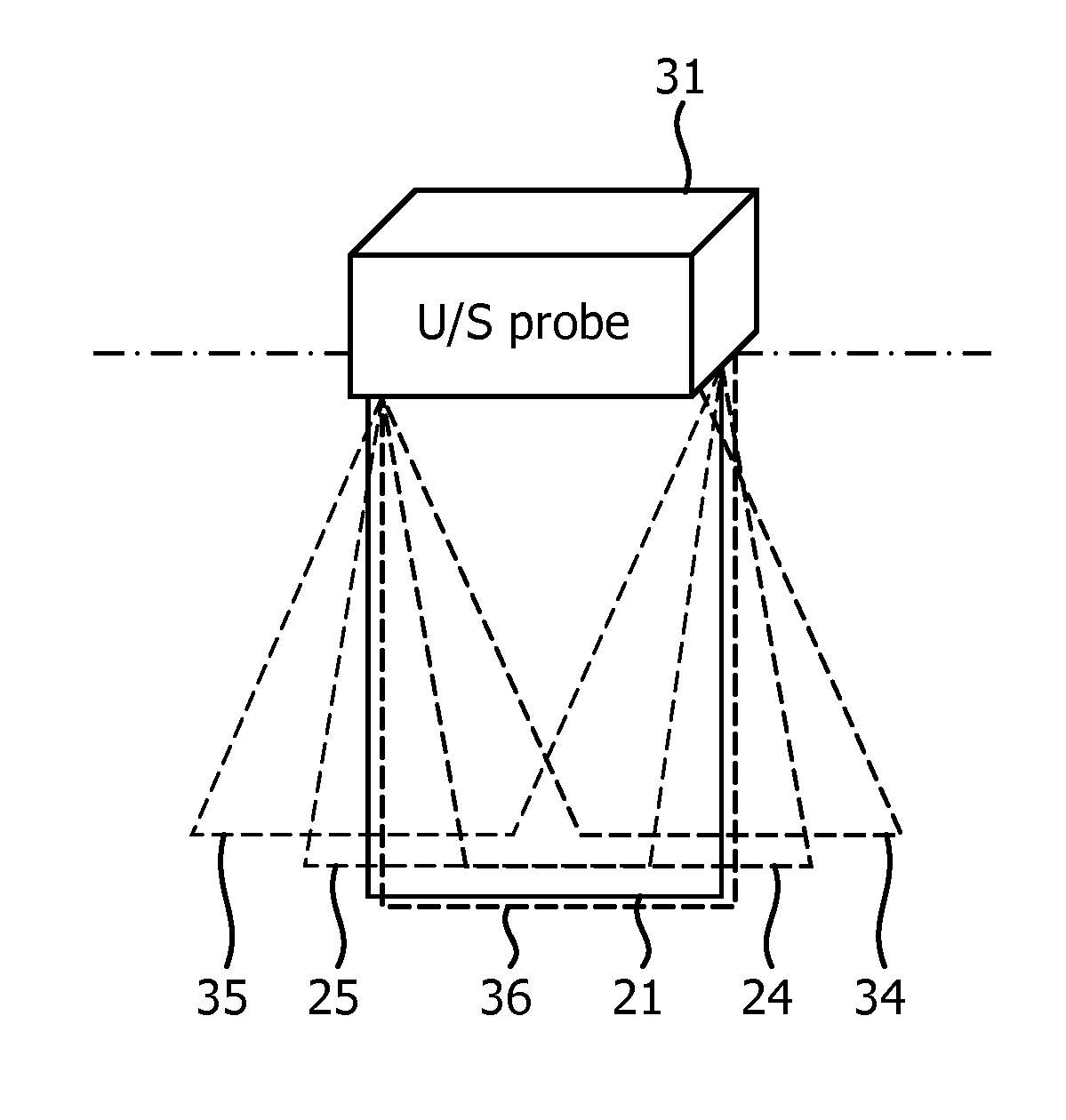 Ultrasonic imaging apparatus and a method for imaging a specular object and a target anatomy in a tissue using ultrasond