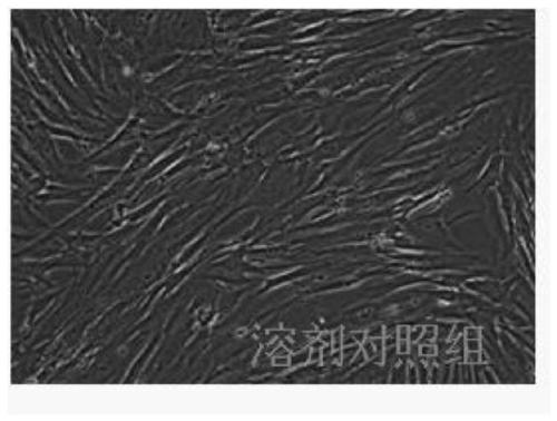 Anti-acne fucoxanthin-agar oligosaccharide composition, preparation method and application of composition