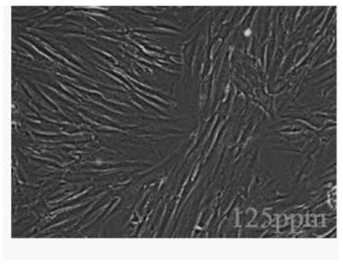 Anti-acne fucoxanthin-agar oligosaccharide composition, preparation method and application of composition