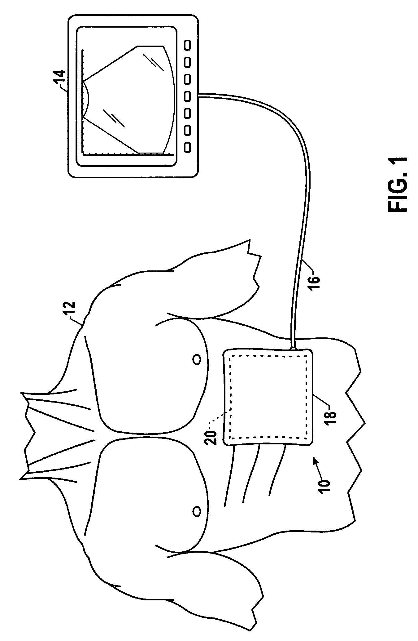 Systems and methods for operating a two-dimensional transducer array