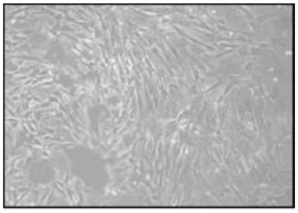 Human umbilical cord mesenchymal stem cell-derived stem cell factor microvesicle preparation and preparation method