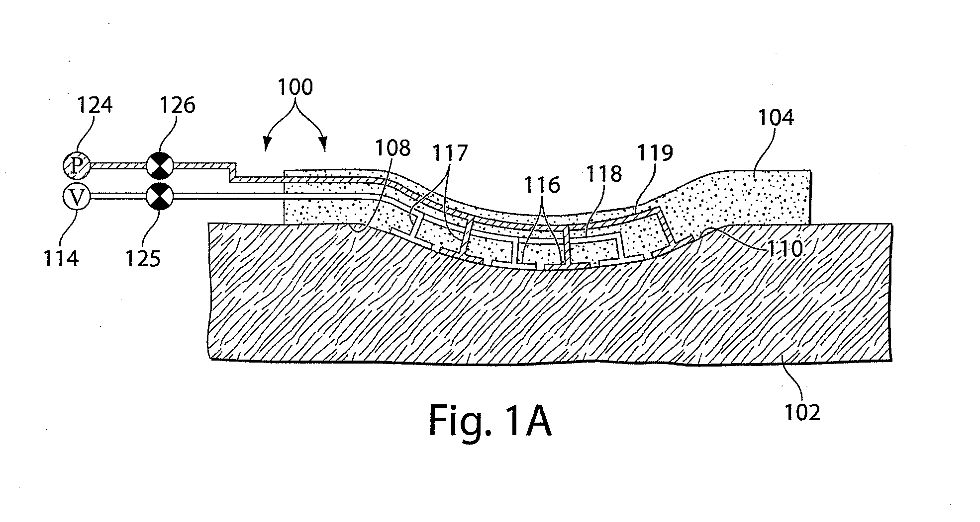 Wound healing device