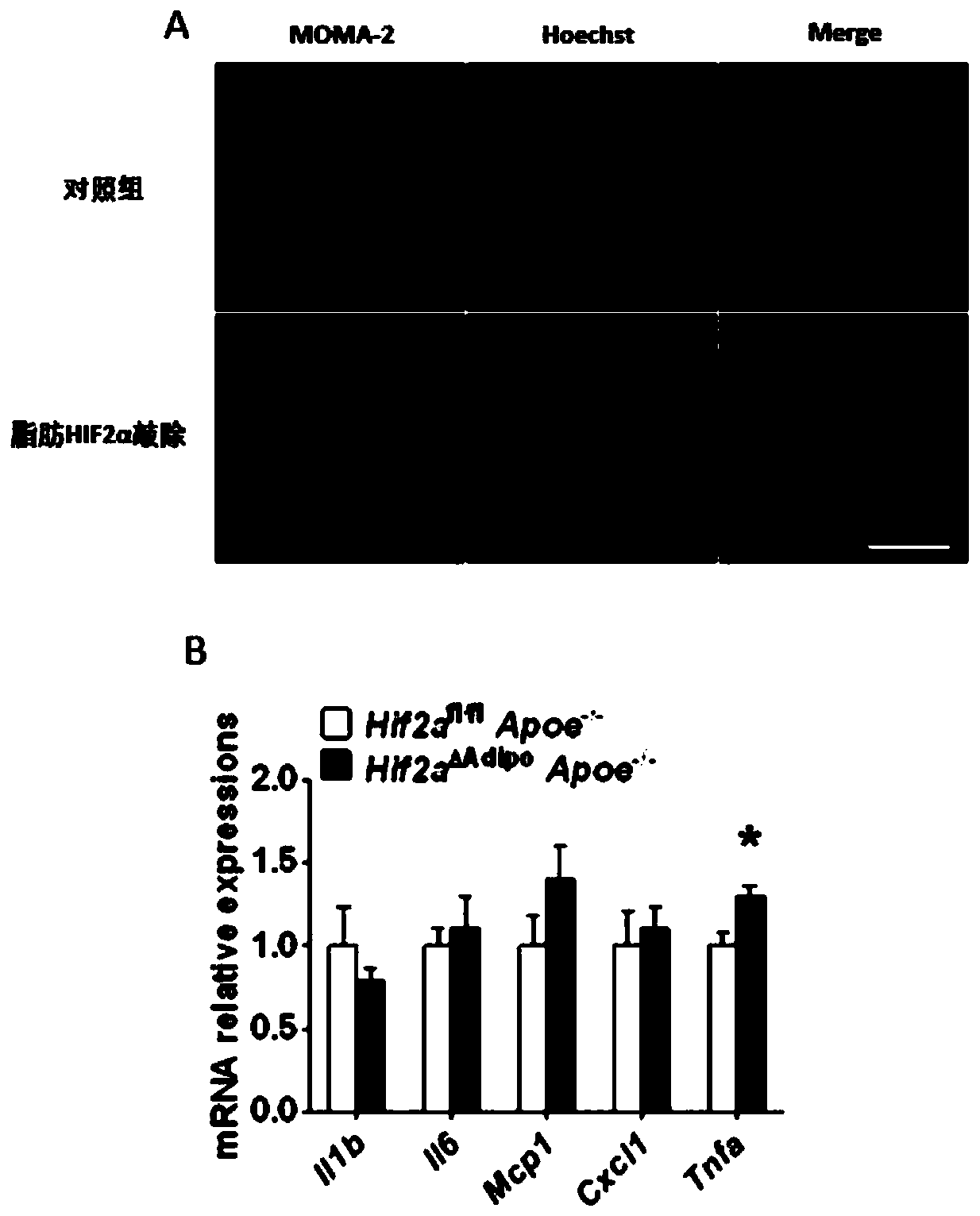Application of HIF2alpha agonist and ACER2 agonist in preparation of medicine for treating atherosclerosis