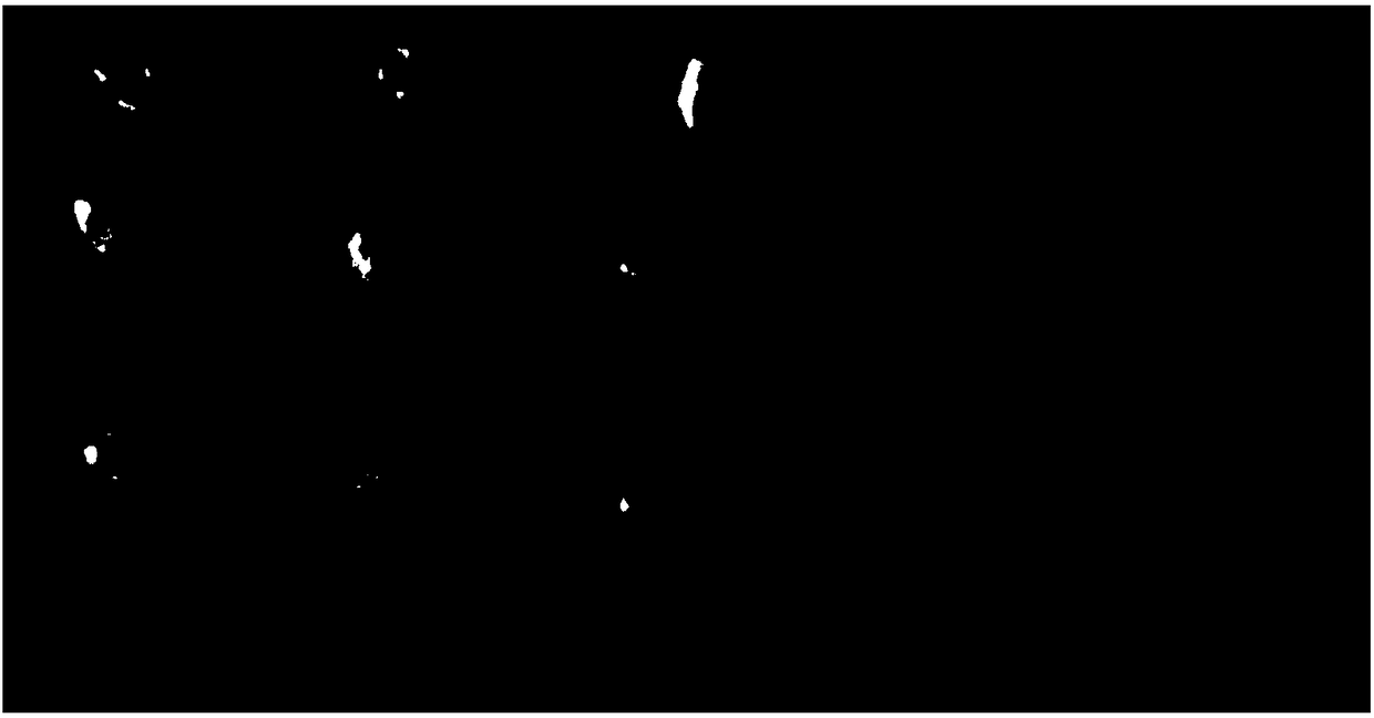 Traditional Chinese medicine composition for preventing and treating precancerous lesions of liver and liver cancer, and preparation method thereof