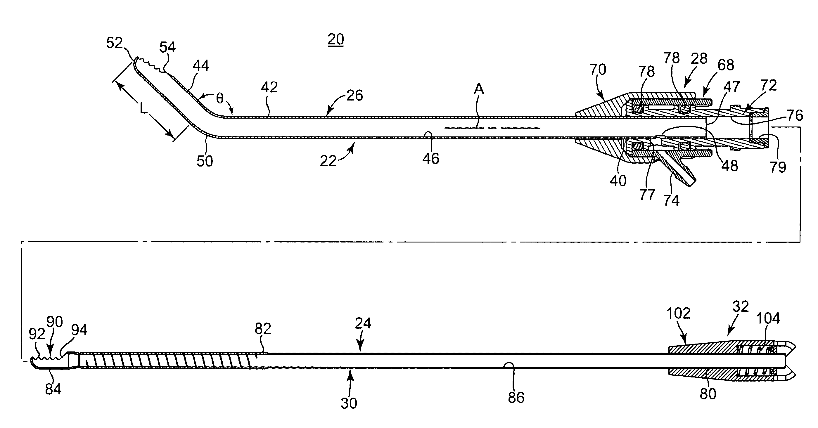 Method and apparatus for removing material from an intervertebral disc space, such as in performing a nucleotomy