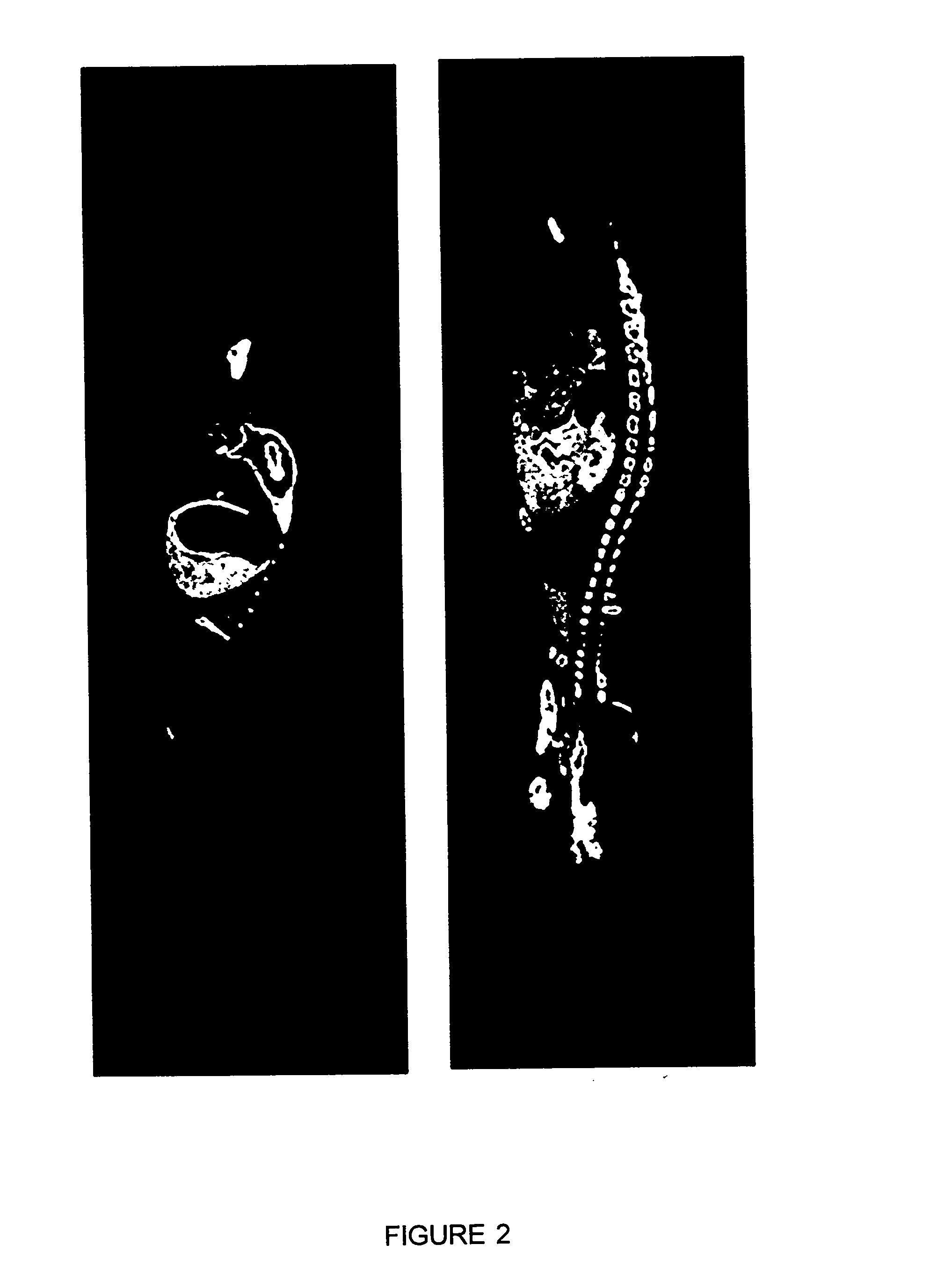 Therapeutic use of the smr1 protein, the smr1 maturation products, specifically the qhnpr pentapeptide as well as its biologically active derivatives