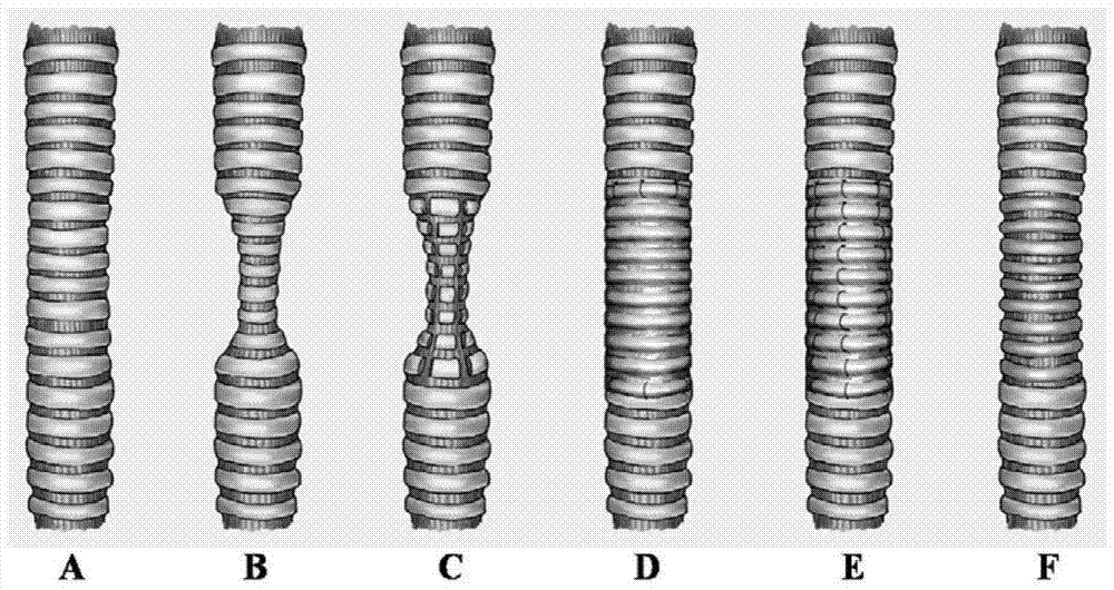 A kind of trachea support and its application