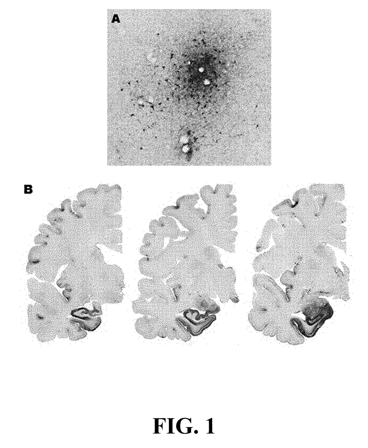 Method for preventing and/or treating chronic traumatic encephalopathy - iii