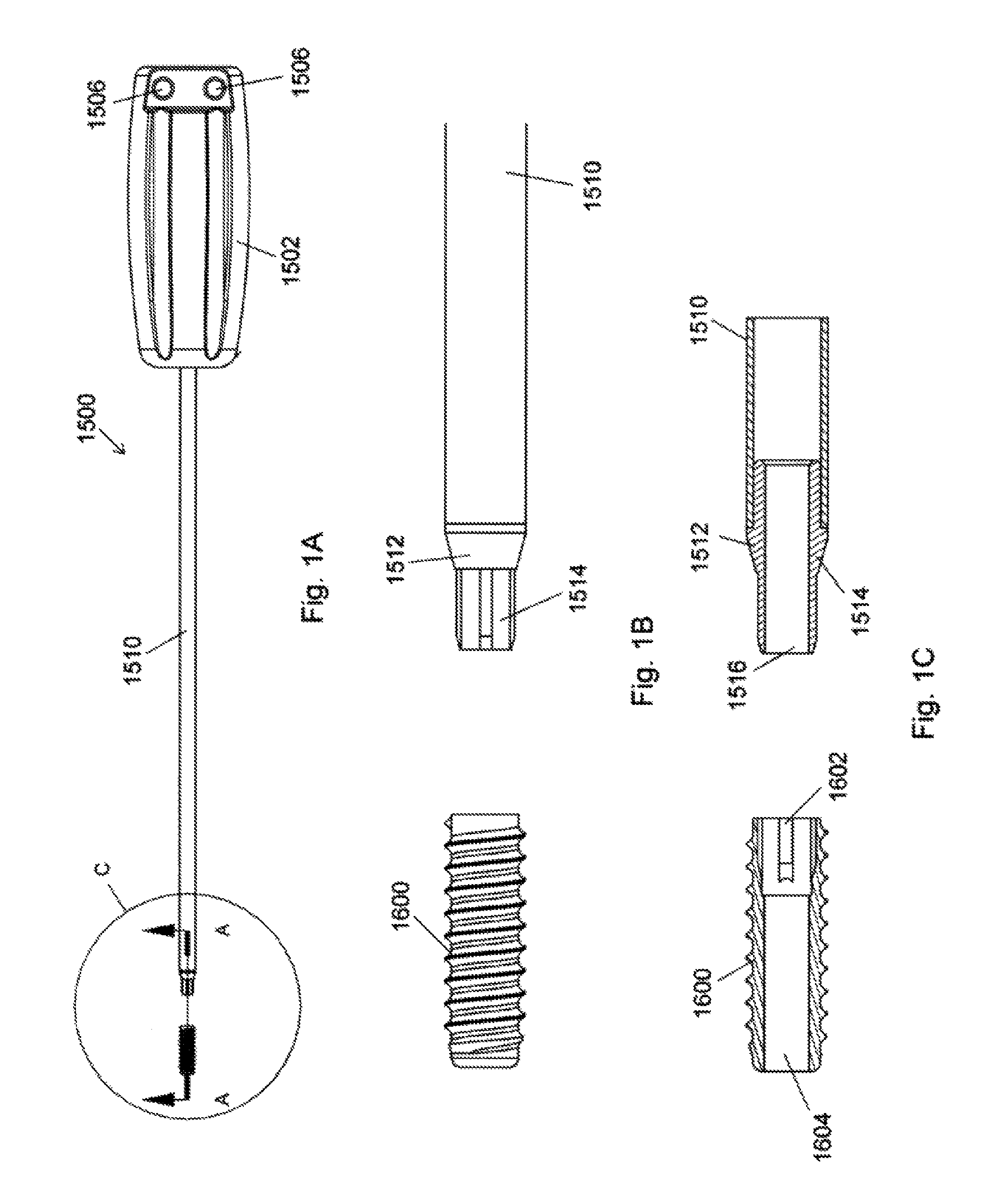 Implant placement systems, devices and methods