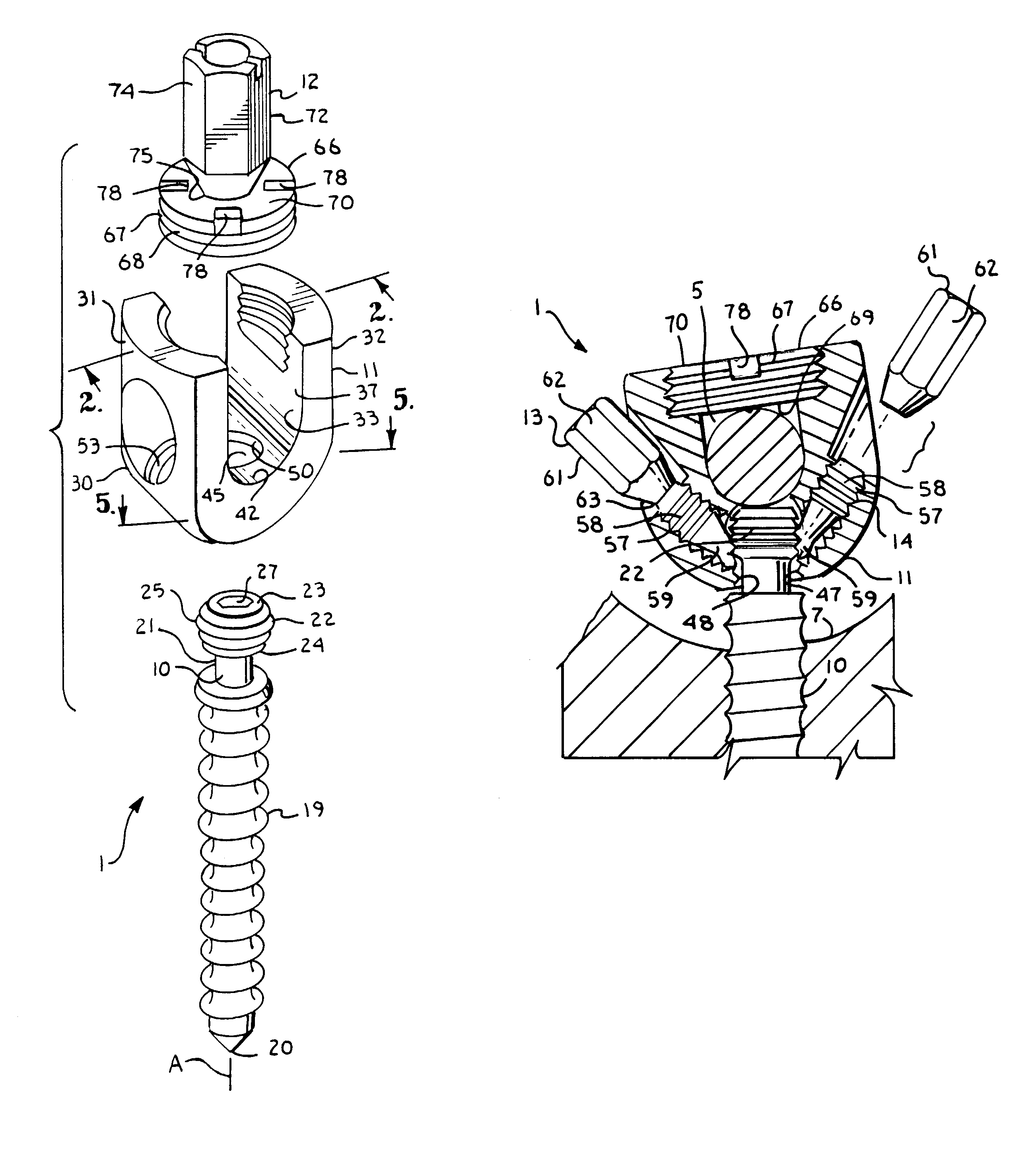 Polyaxial bone screw locking mechanism