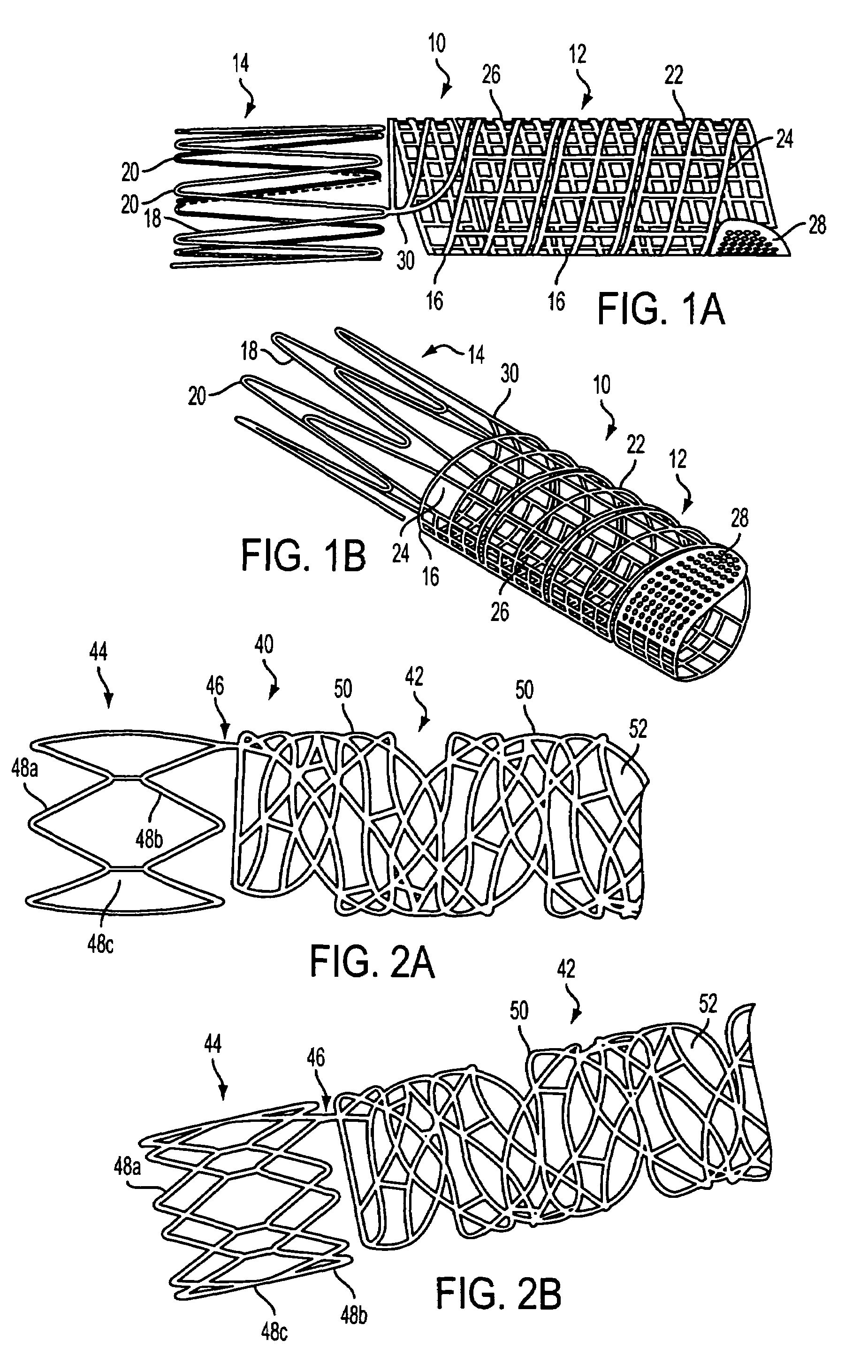 Delivery catheter for ribbon-type prosthesis and methods of use