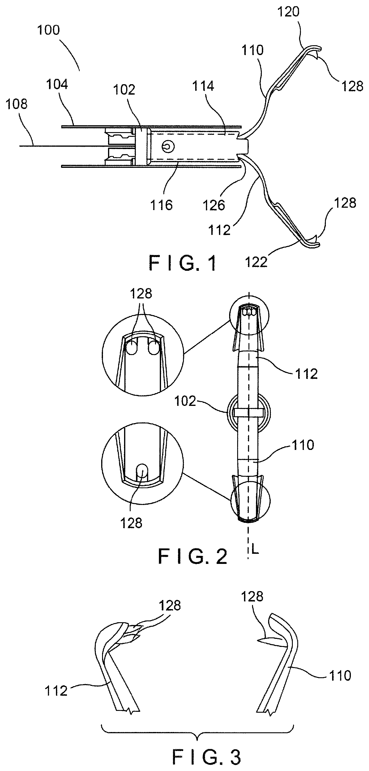 Aggressive featured clips with improved tissue retention