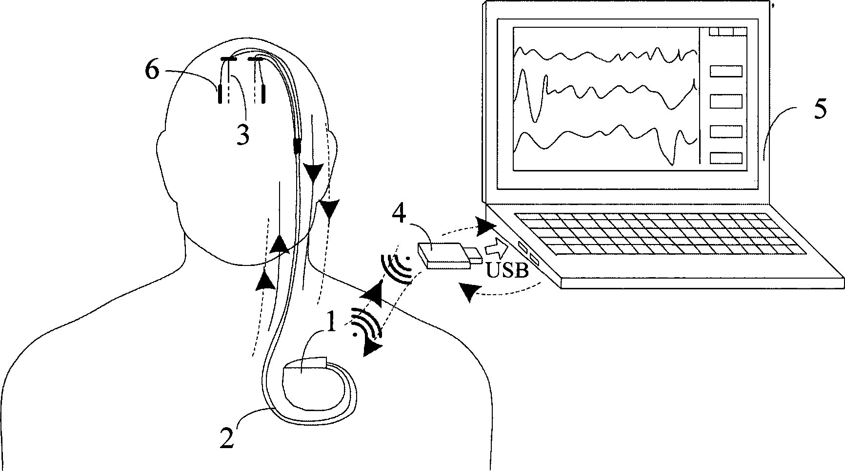 Closed loop nerve stimulation system