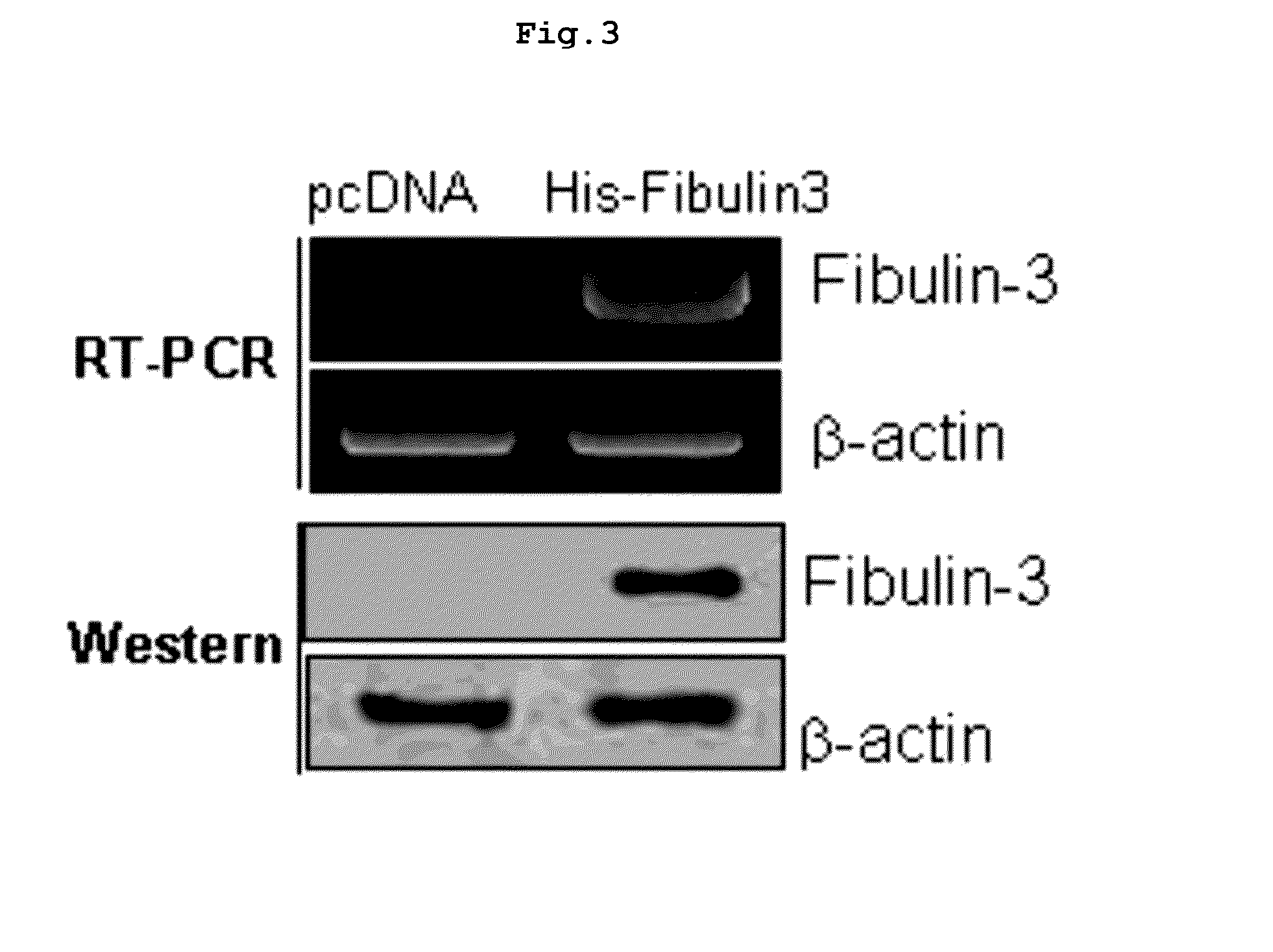 Pharmaceutical composition containing fibulin-3 protein as an active ingredient for inhibiting the growth of cancer stem cells