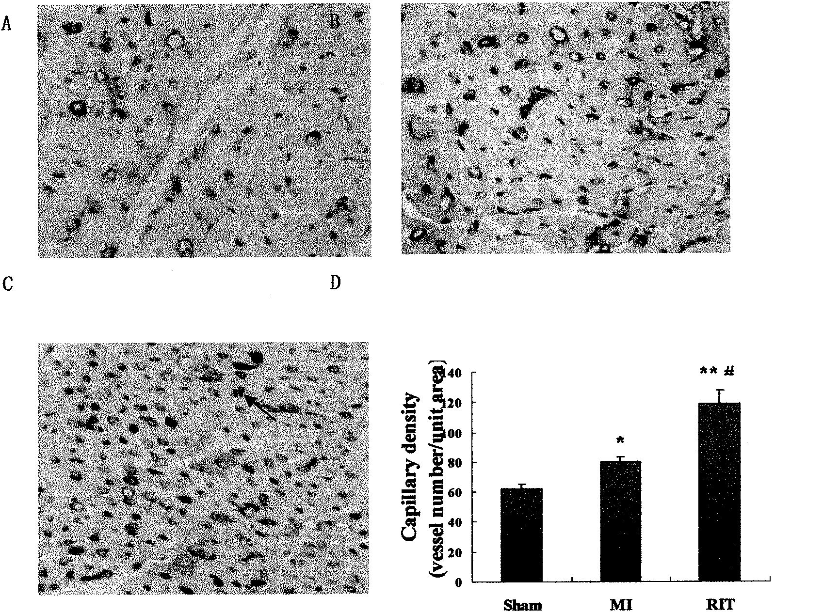 Device for promoting pathologic ischemia position collateral circulation formation through physiological ischemia training