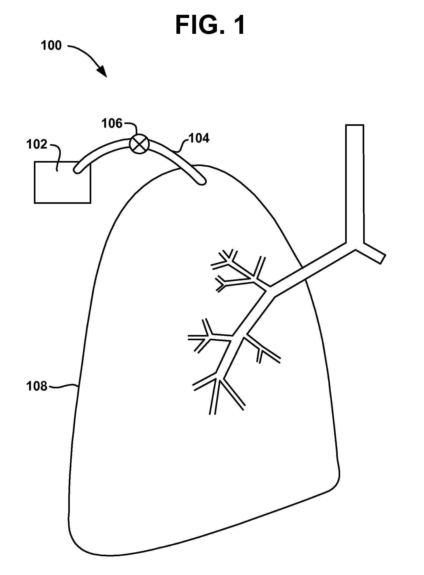 Devices and methods to create and maintain the patency of an opening relative to parenchymal tissue of the lung