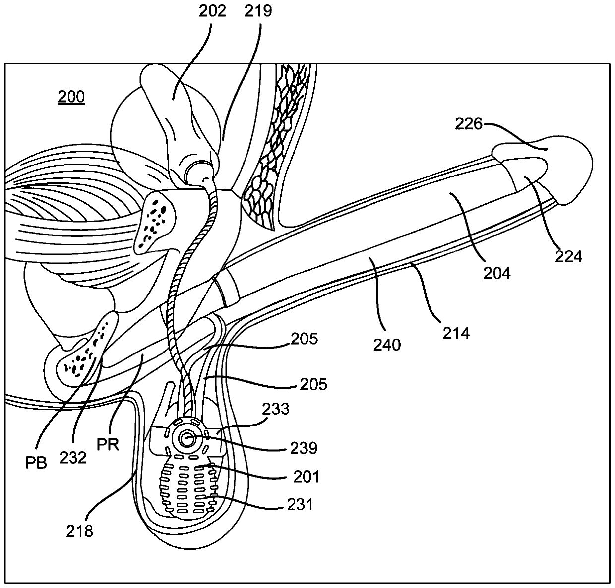 Inflatable penile prosthesis with reinforced members