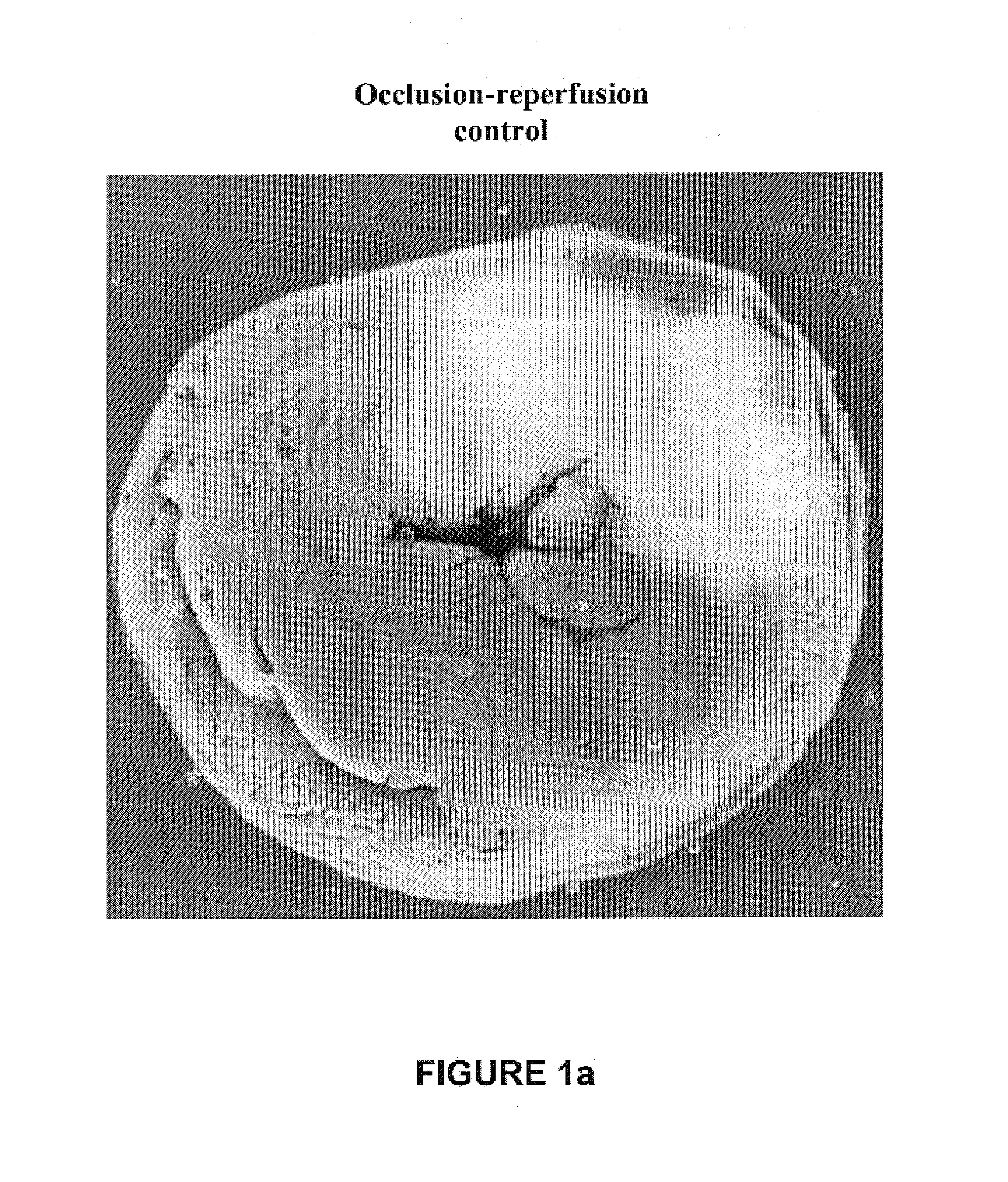Cardioprotective delta opioid receptor agonists and methods of using same