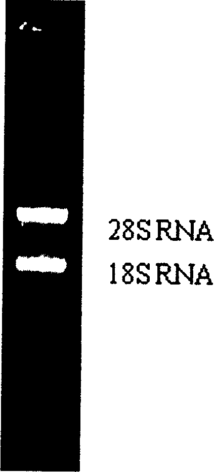 Novel thrombase-like gene and its use