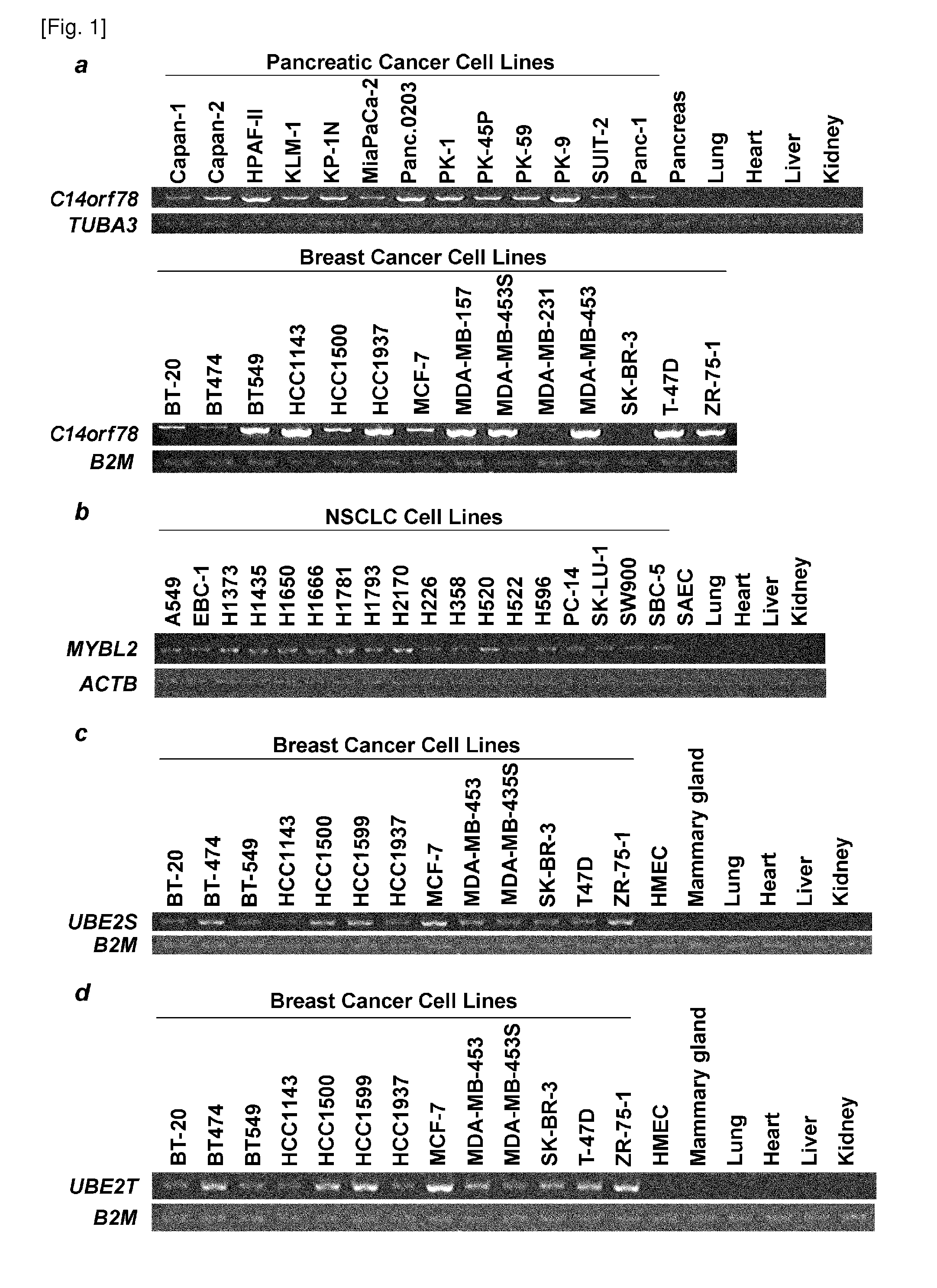Compositions and methods of treating cancer