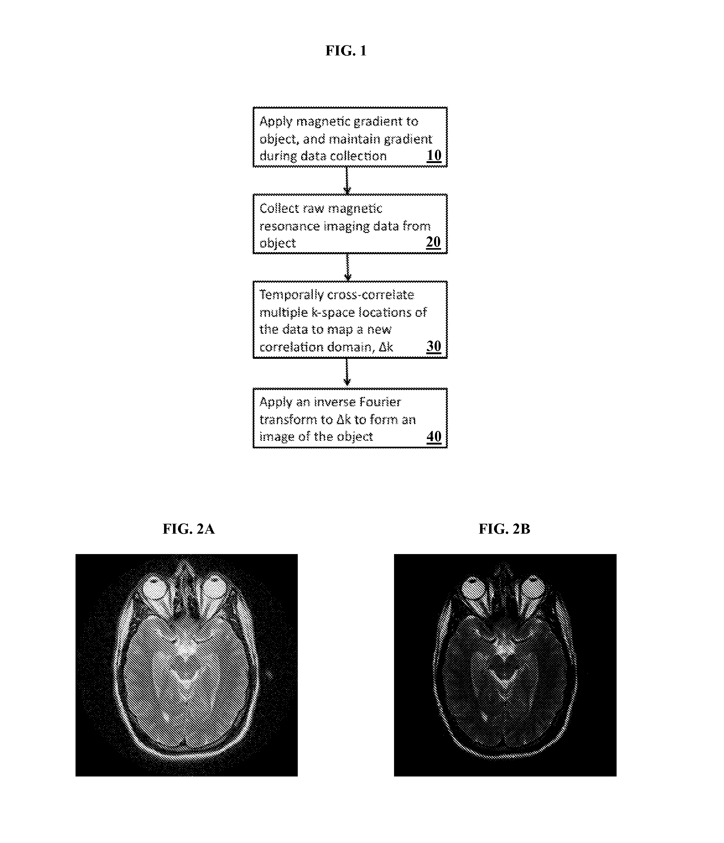 Interferometric Magnetic Resonance Imaging System and Related Method