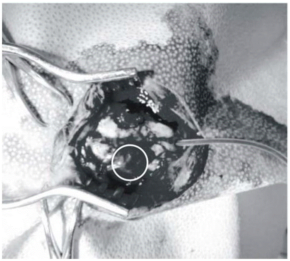 A kind of chitosan nanofibrous membrane for dura mater or dura mater repair and its preparation method and application