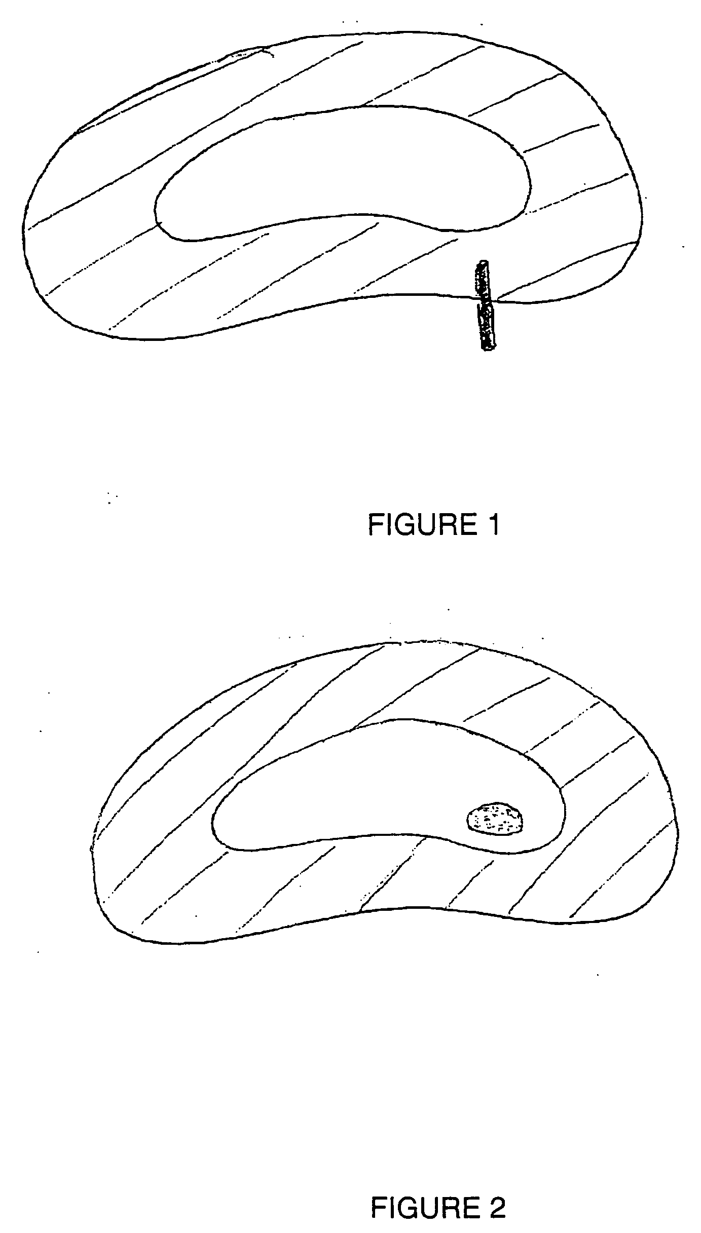 Disc augmentation using materials that expand in situ