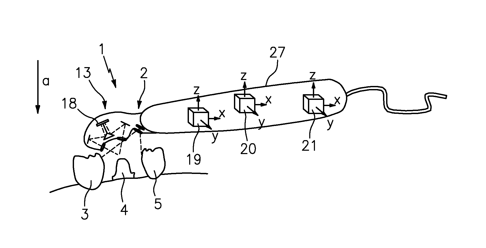 Device for determining the 3D coordinates of an object, in particular of a tooth