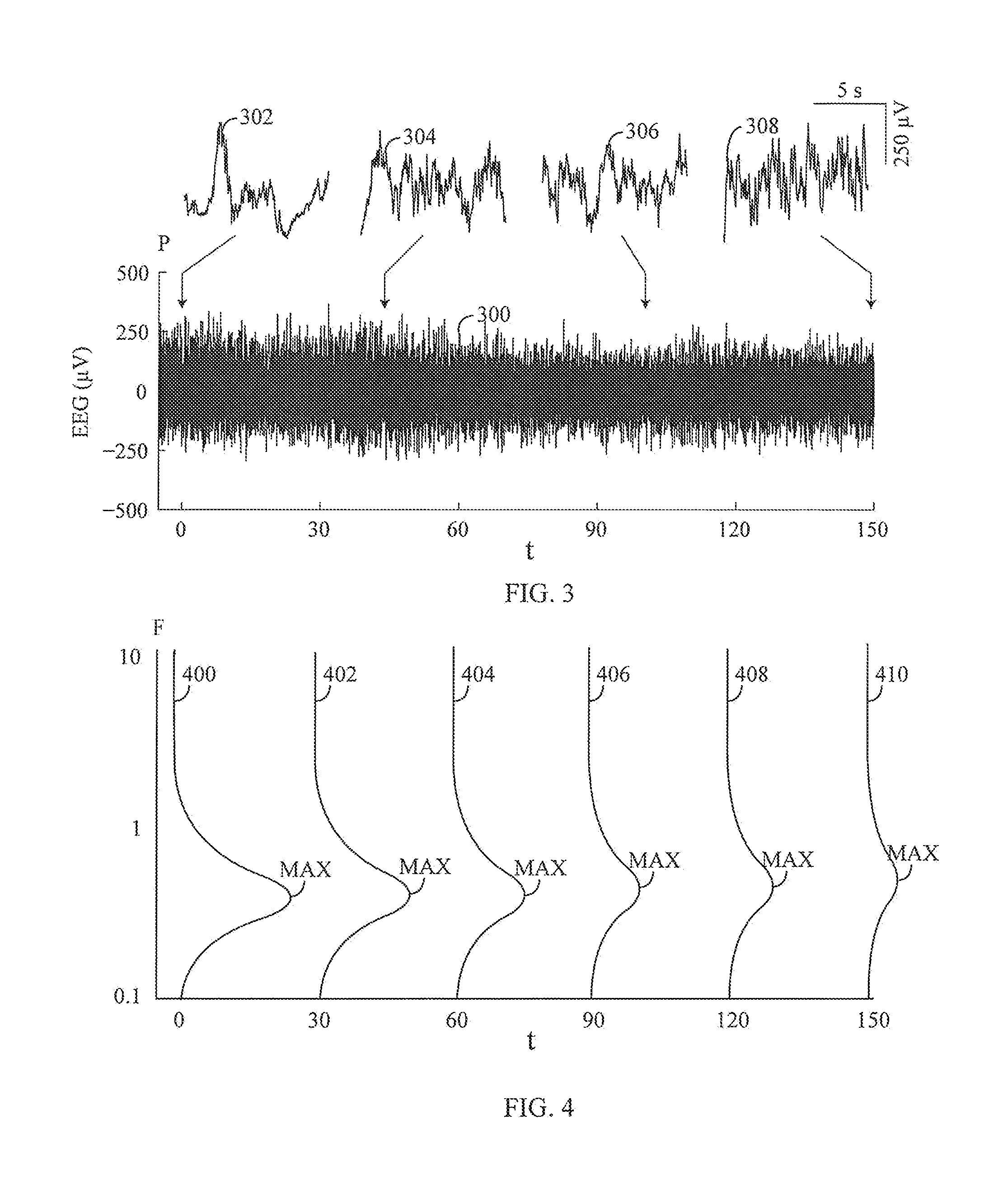 Apparatus and method for electroencephalographic examination