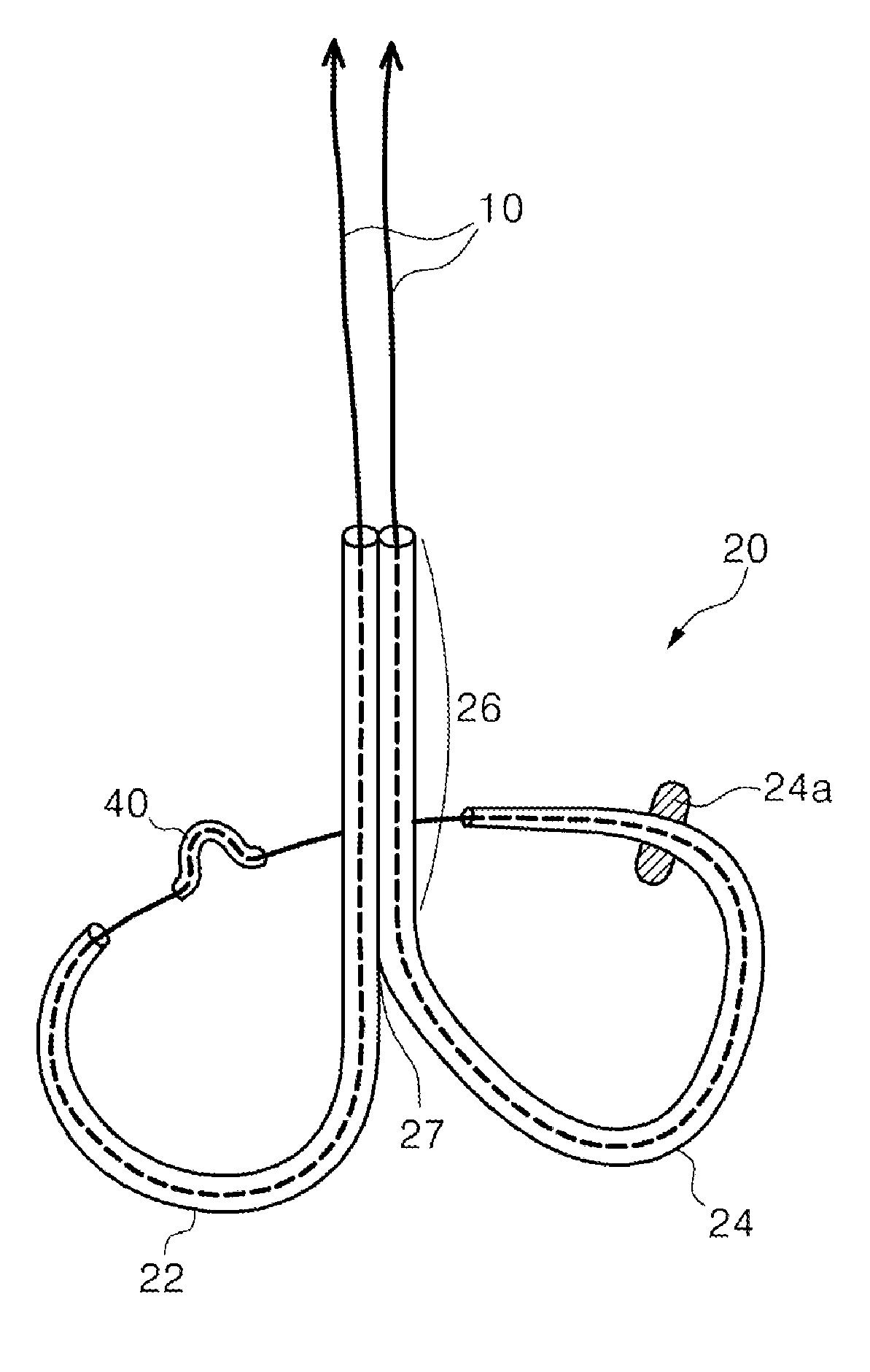 Mitral cerclage annuloplasty apparatus