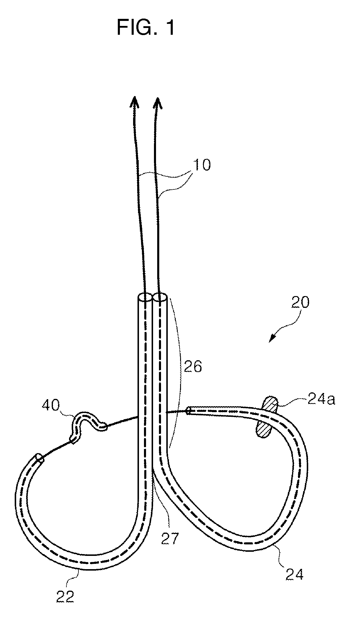 Mitral cerclage annuloplasty apparatus