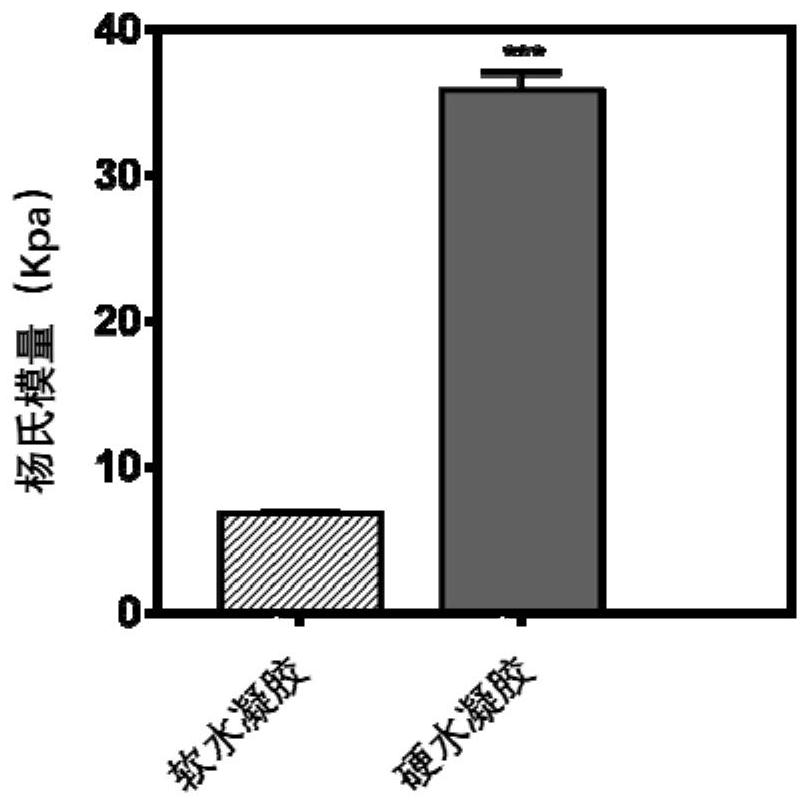 A kind of polyethylene glycol-based hydrogel and its preparation method and application