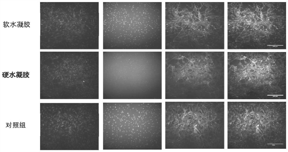 A kind of polyethylene glycol-based hydrogel and its preparation method and application