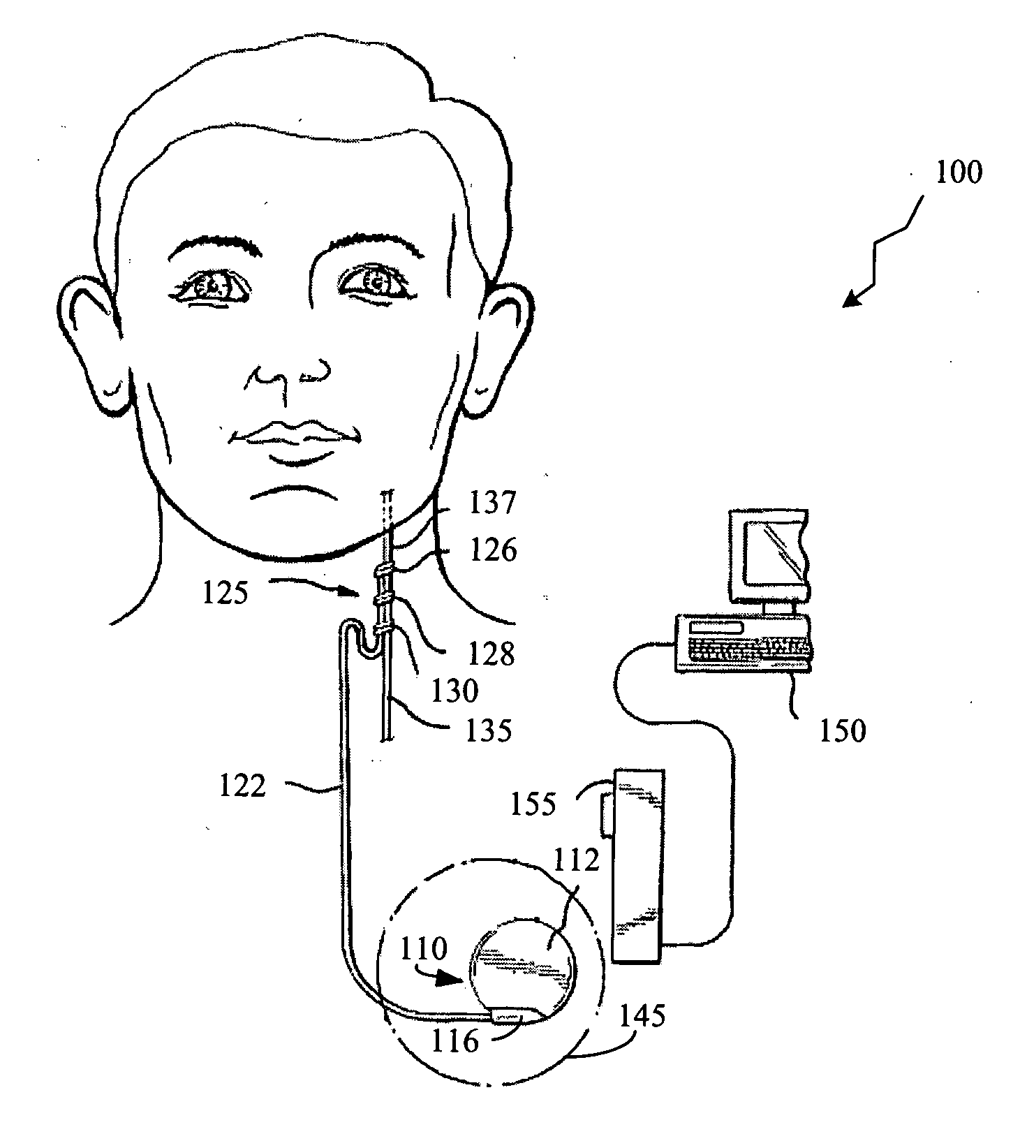 Patient management system for providing parameter data for an implantable medical device