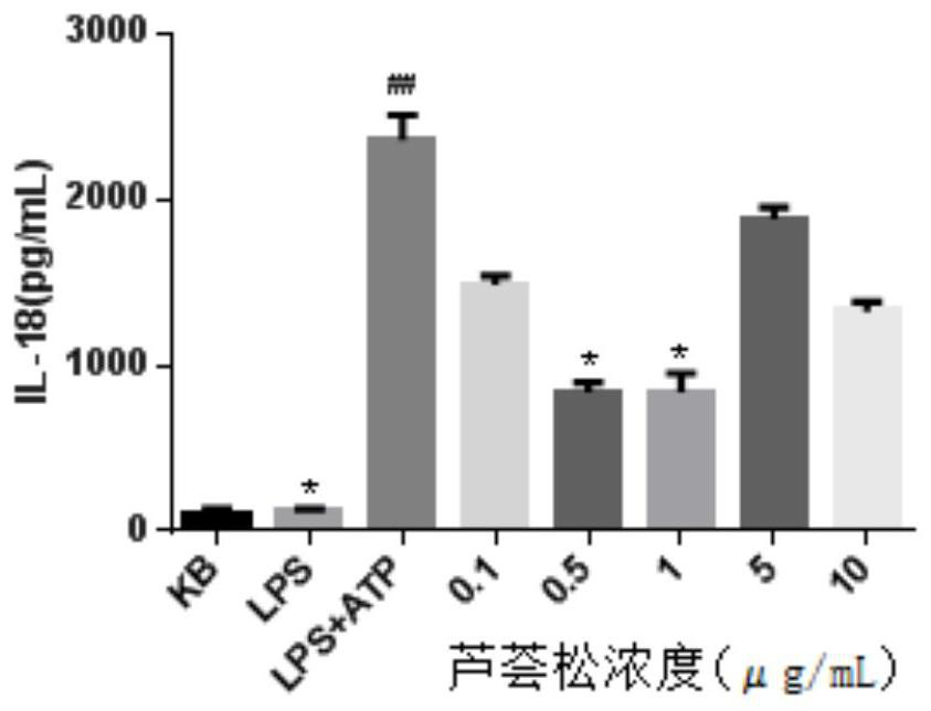 Application of aloesome in preparation of medicine for treating ulcerative colitis