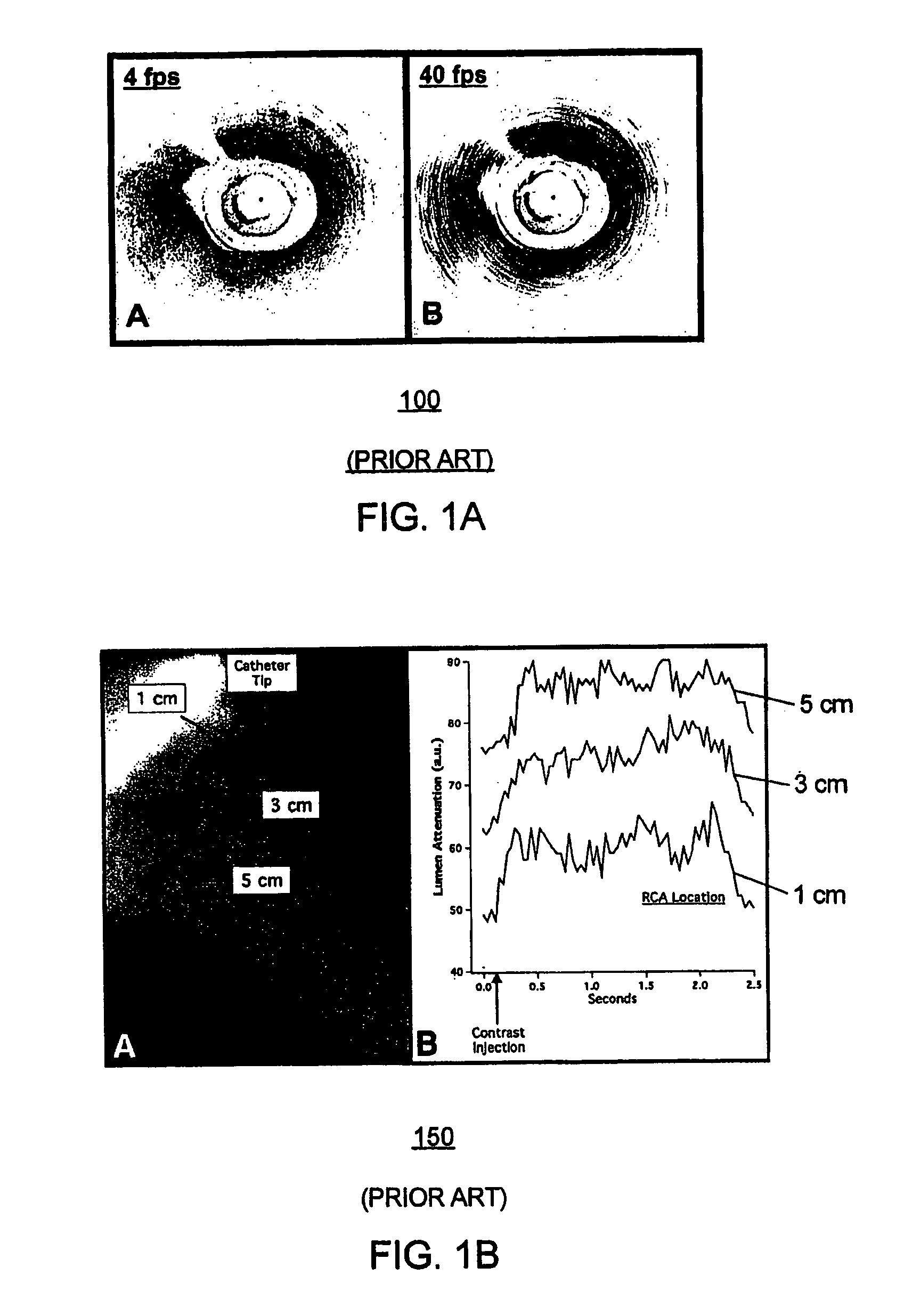 Method and apparatus for imaging of vessel segments