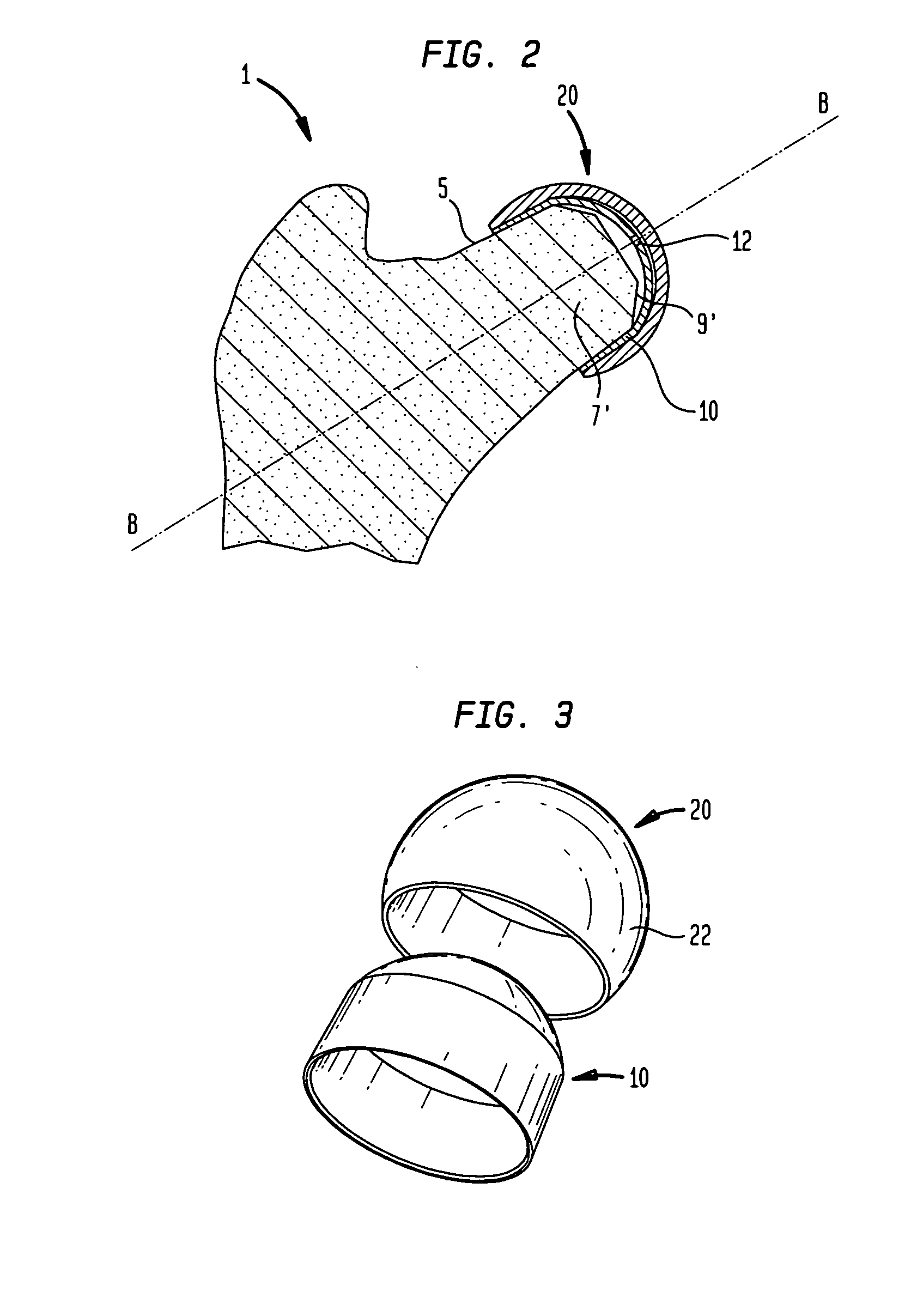 Method and apparatus for hip femoral resurfacing tooling