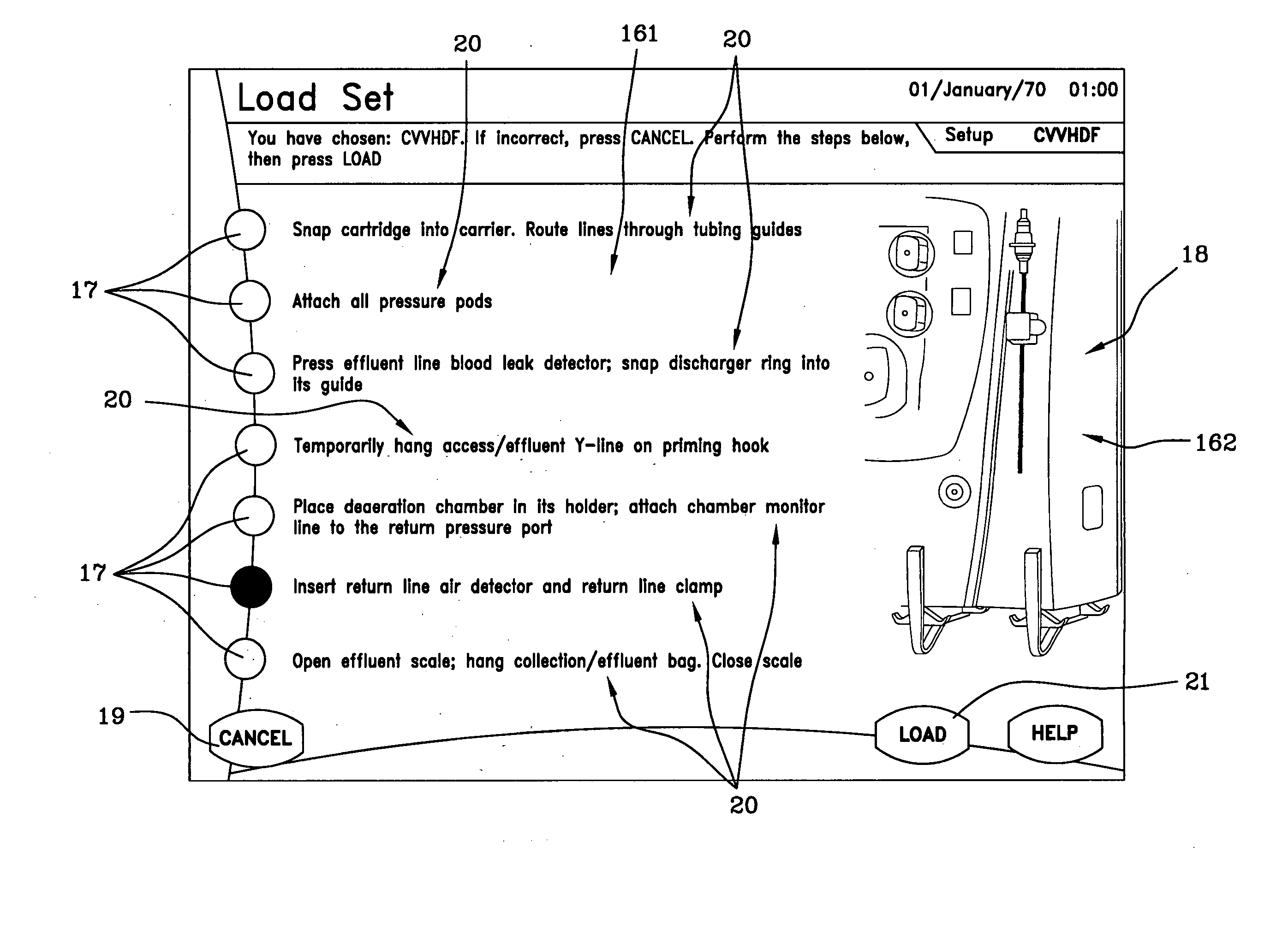 User interface for an extracorporeal blood treatment machine